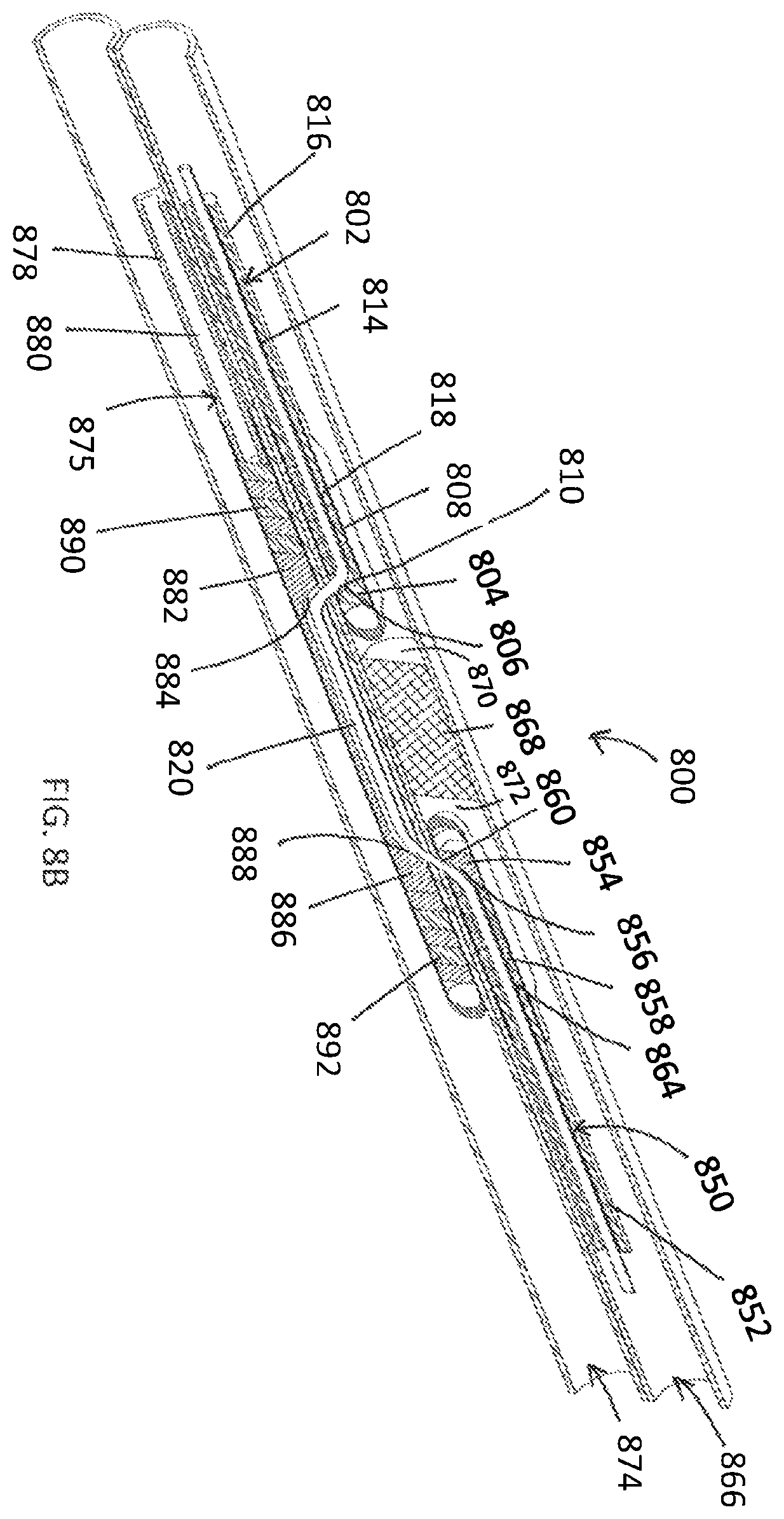 Patent US12508400 Figure 9 – Devices and methods for advancing a wire
