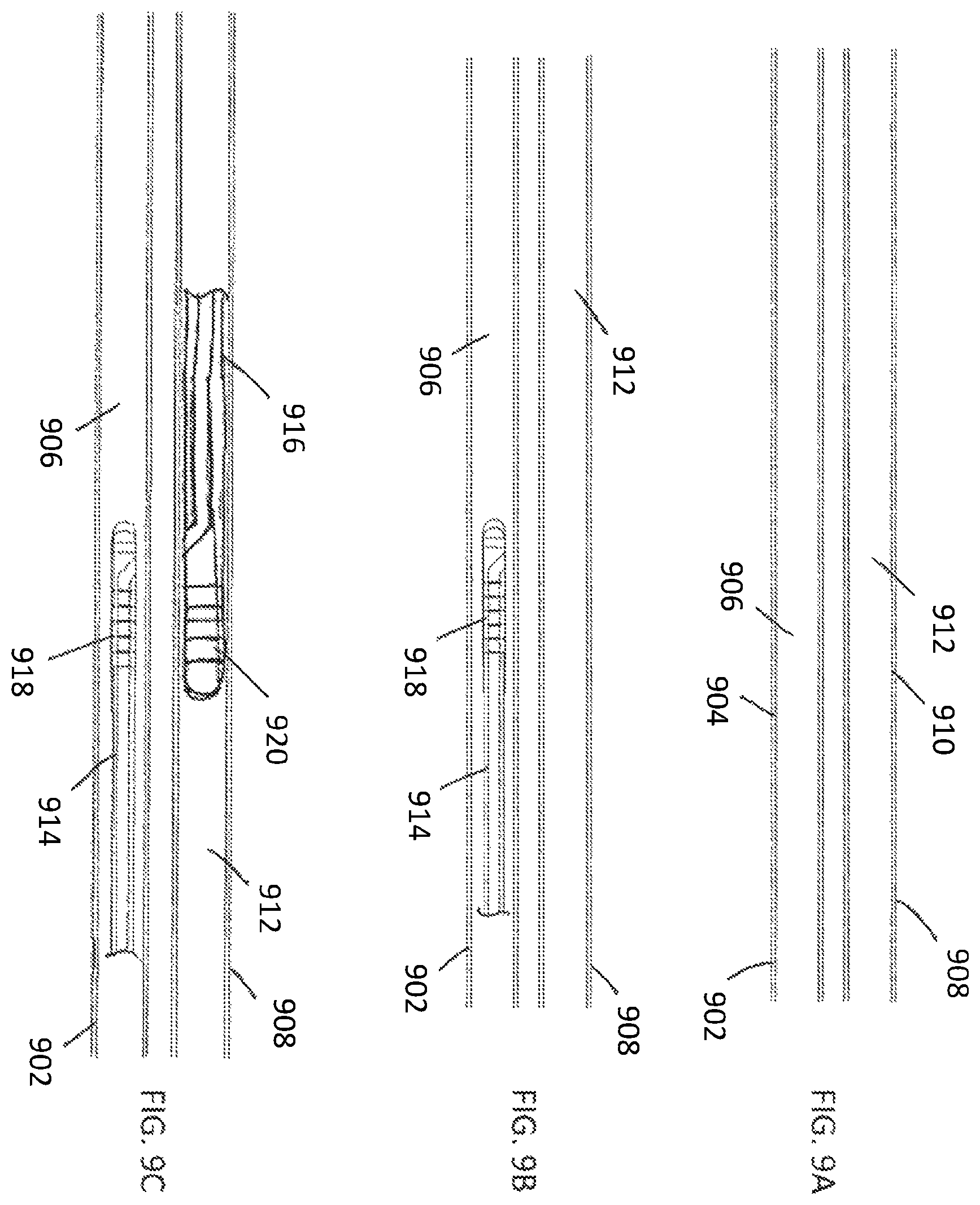 Patent US12508400 Figure 10 – Devices and methods for advancing a wire
