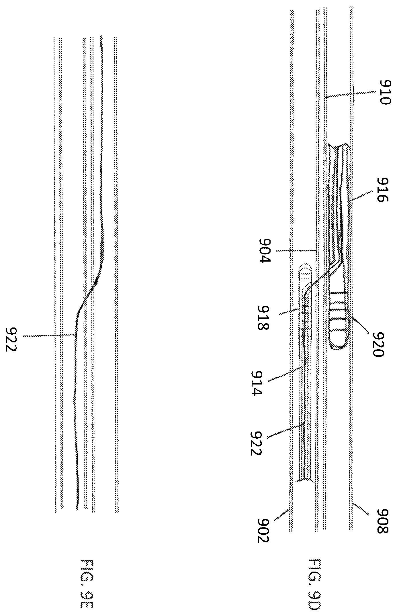 Patent US12508400 Figure 11 – Devices and methods for advancing a wire