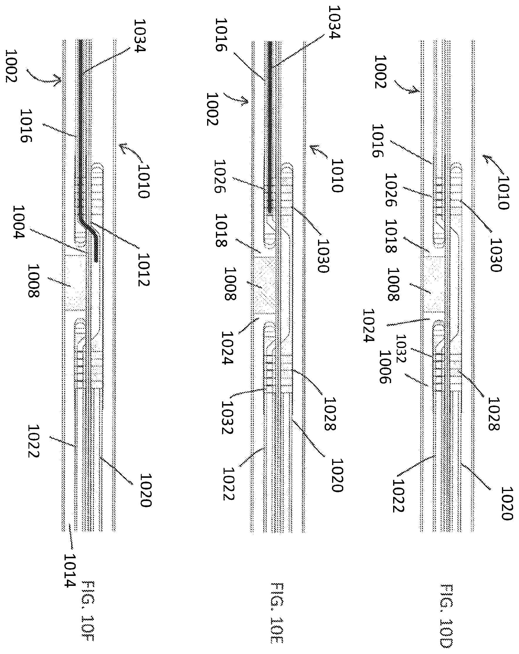Patent US12508400 Figure 13 – Devices and methods for advancing a wire