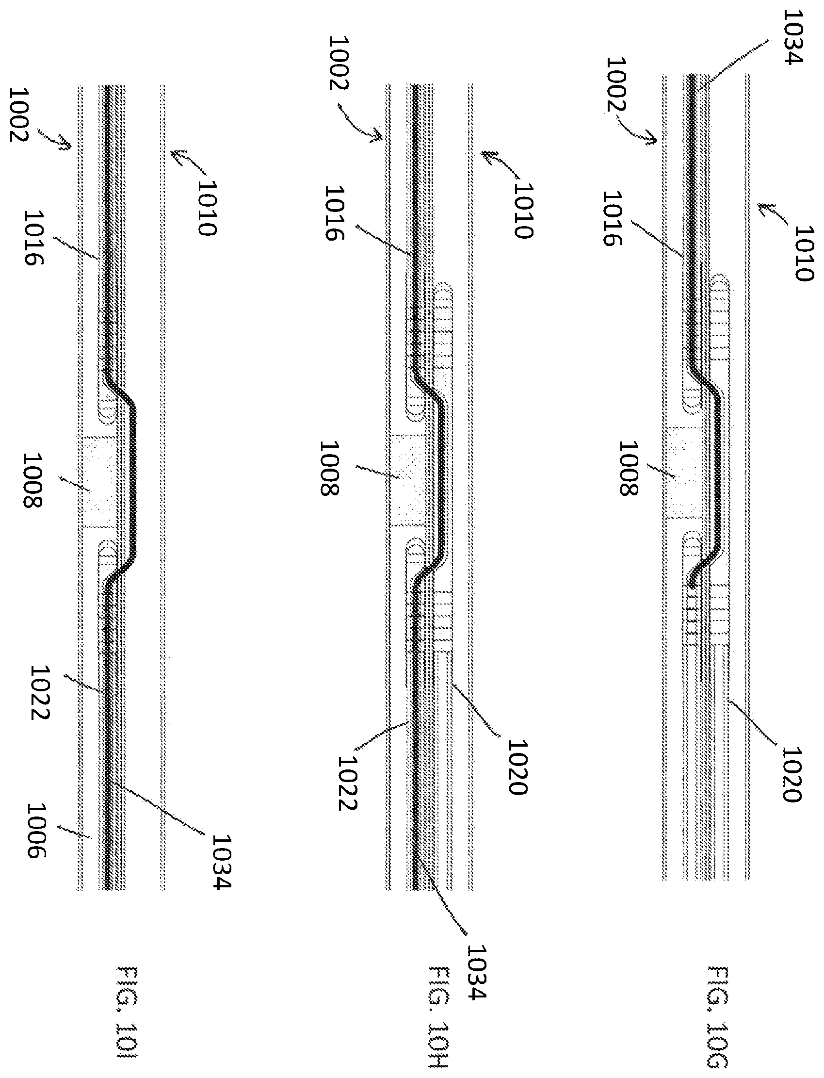 Patent US12508400 Figure 14 – Devices and methods for advancing a wire
