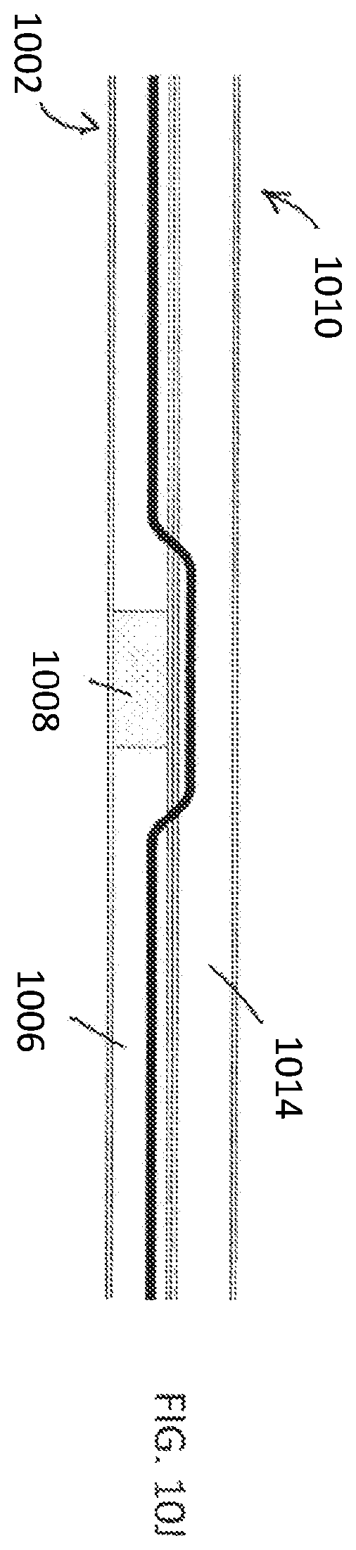 Patent US12508400 Figure 15 – Devices and methods for advancing a wire