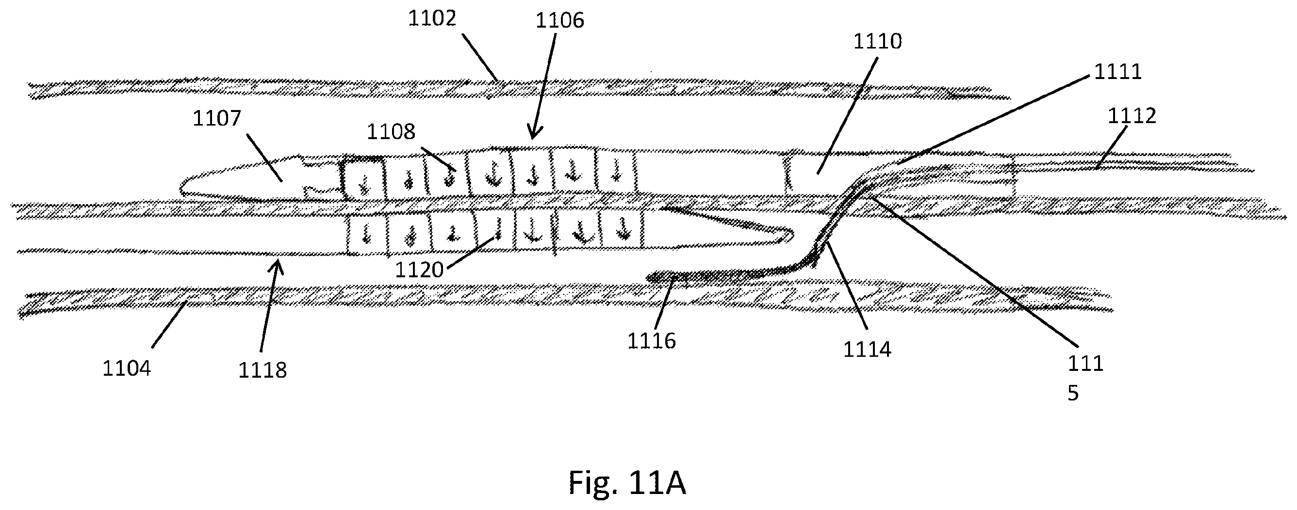 Patent US12508400 Figure 16 – Devices and methods for advancing a wire