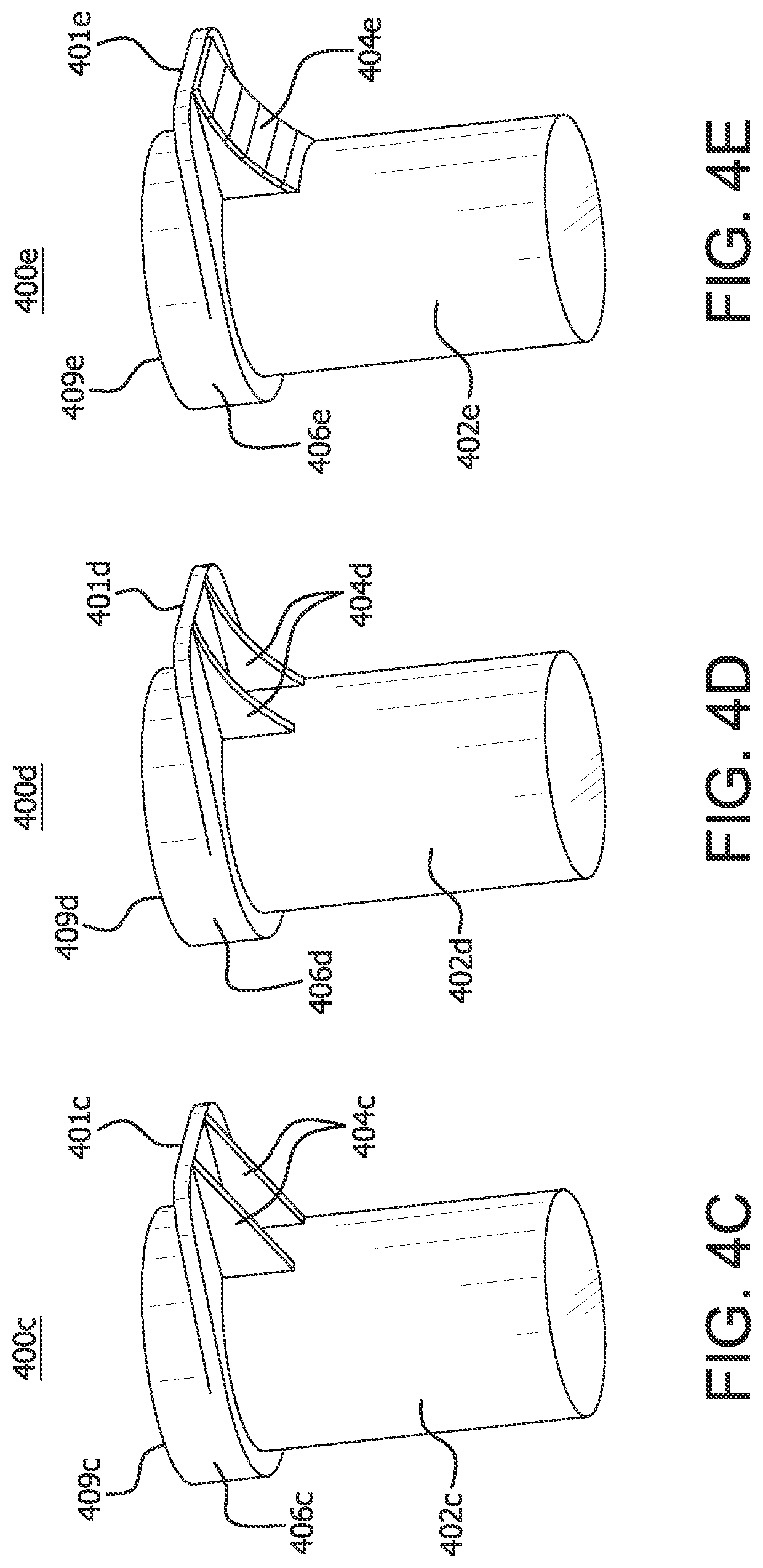 Patent US12508403 Figure 6 – Catheter insertion device with improved push tab and tip protector assembly