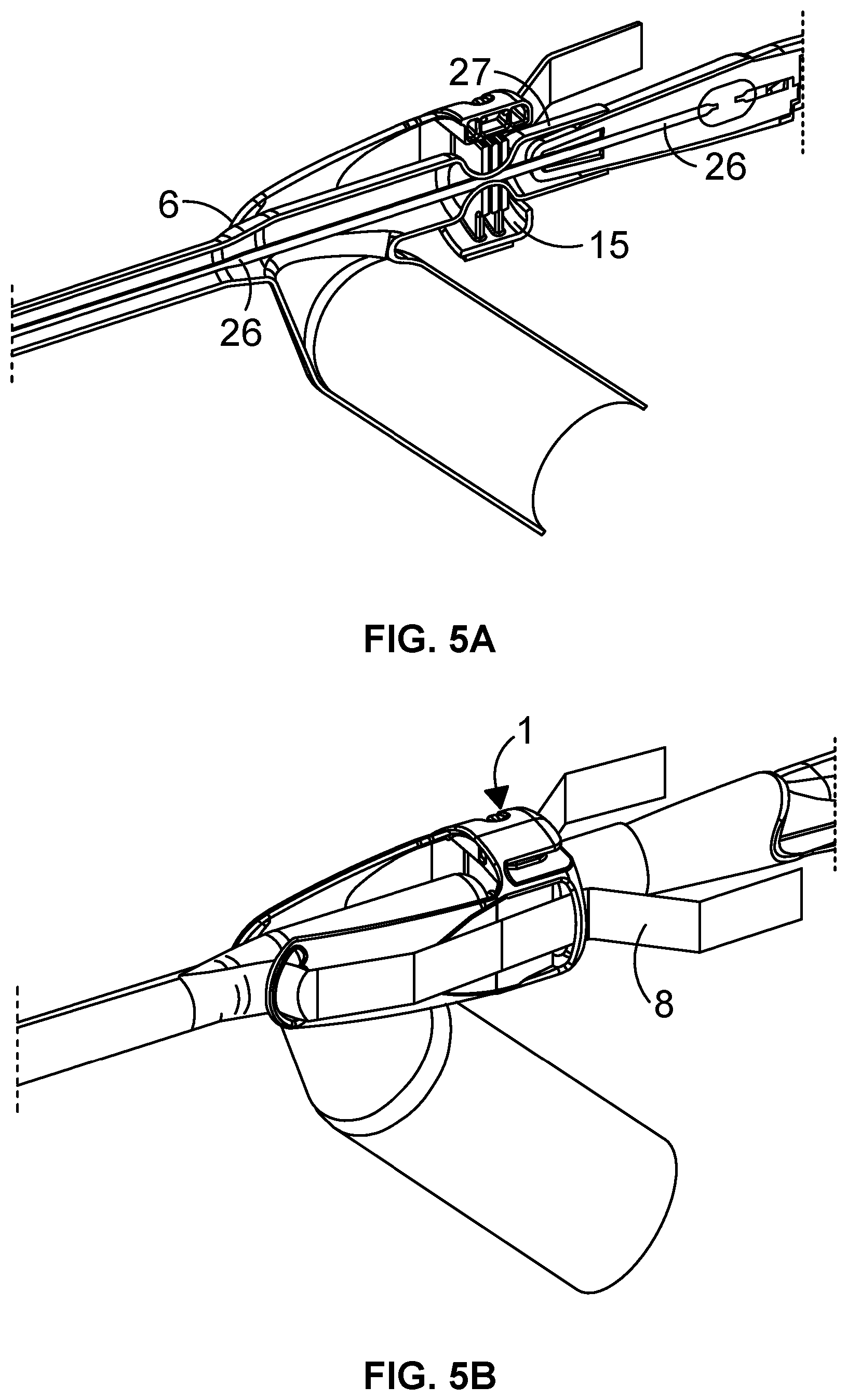 Patent US12508404 Figure 3 – Sheath splitting apparatus