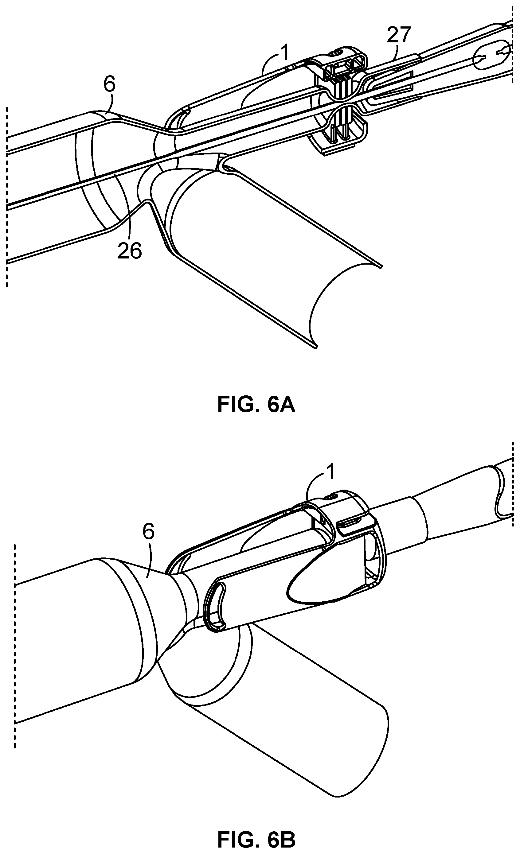Patent US12508404 Figure 4 – Sheath splitting apparatus