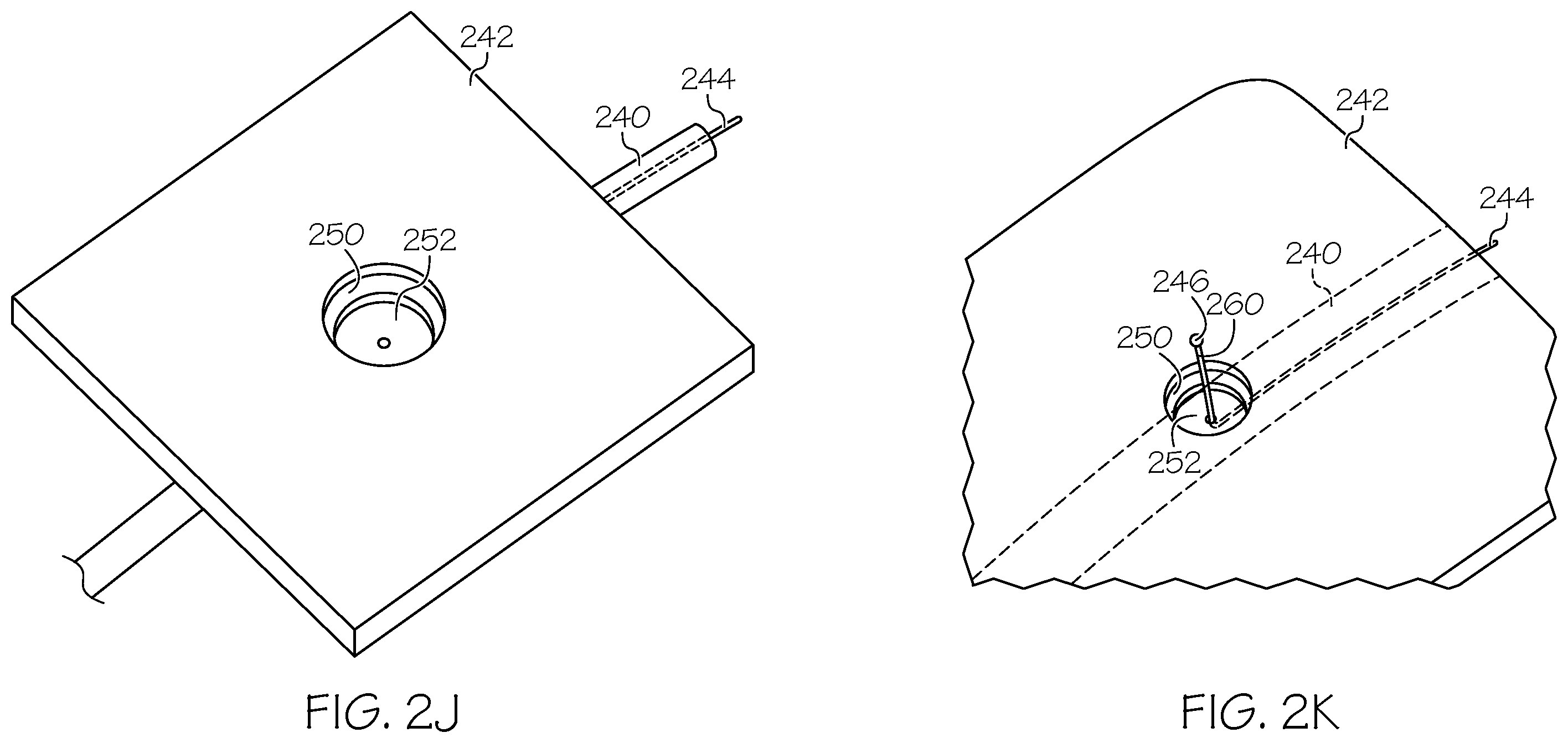 Patent US12508405 Figure 5 – Surgical method, device, system and kit for the treatment of hydrocephalus