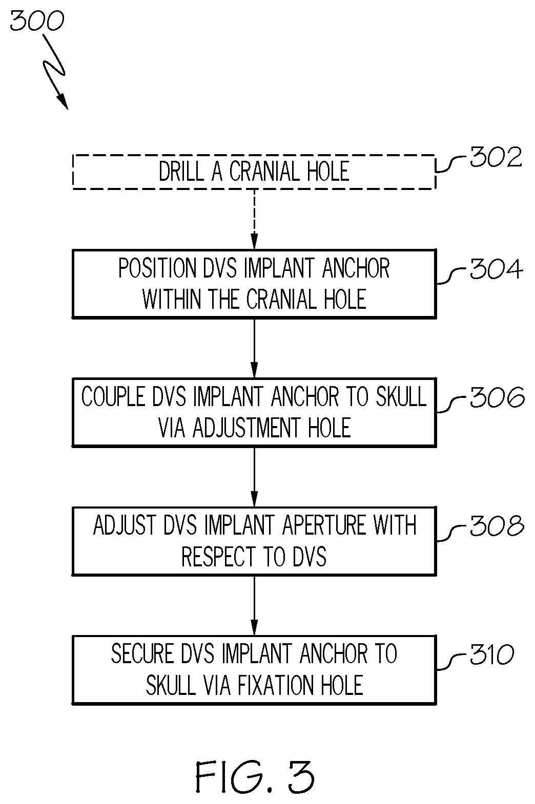 Patent US12508405 Figure 6 – Surgical method, device, system and kit for the treatment of hydrocephalus