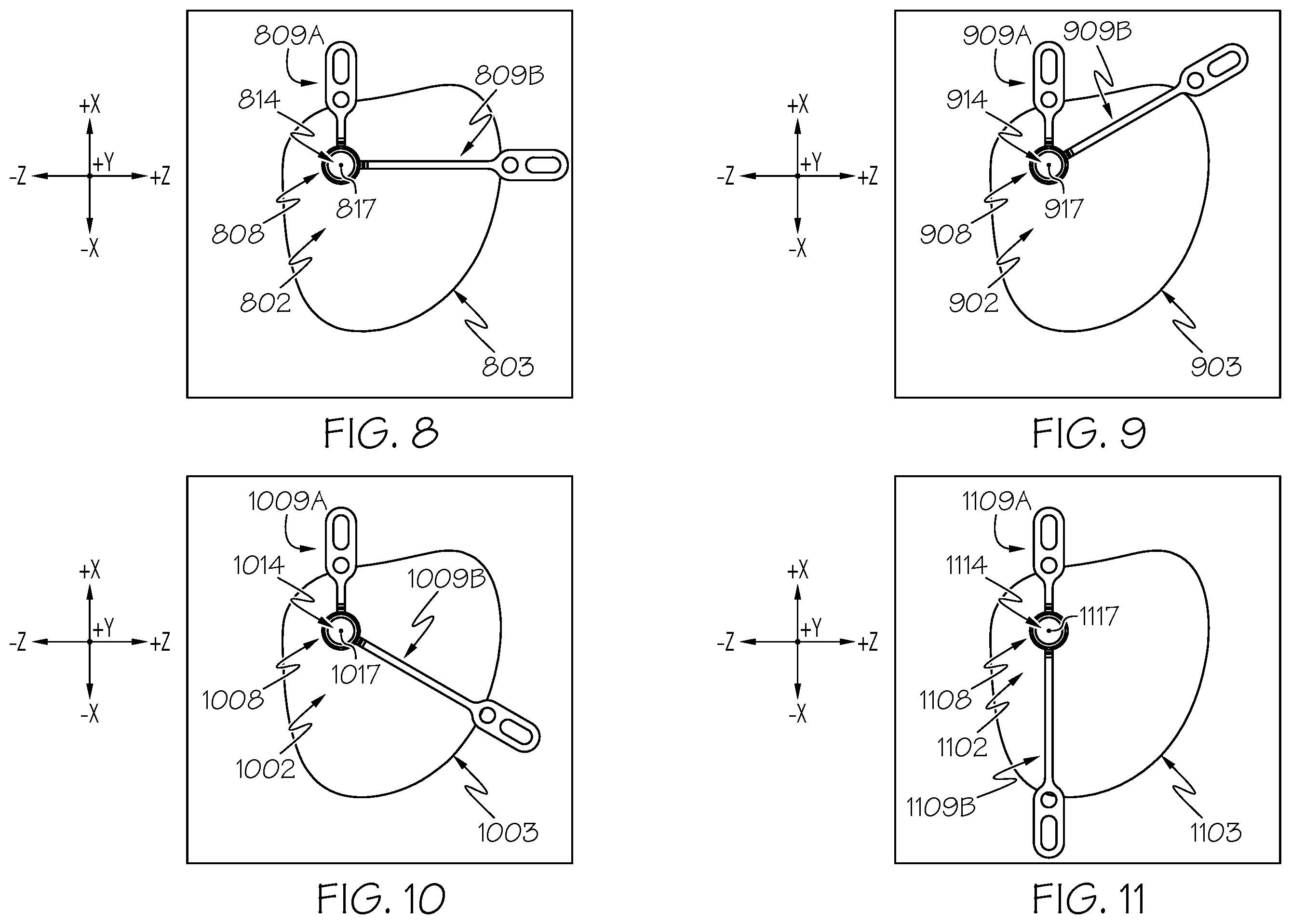 Patent US12508405 Figure 8 – Surgical method, device, system and kit for the treatment of hydrocephalus
