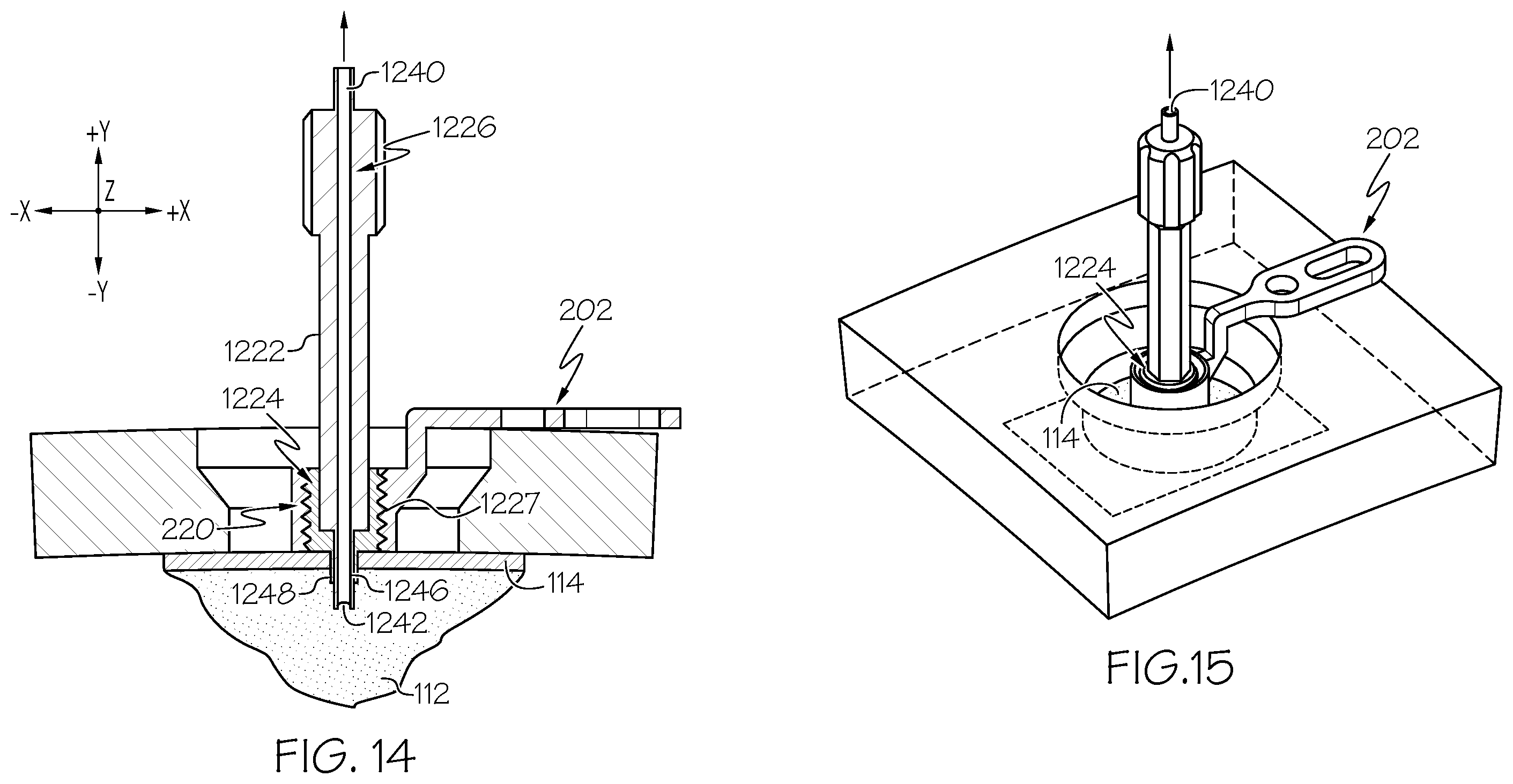 Patent US12508405 Figure 10 – Surgical method, device, system and kit for the treatment of hydrocephalus