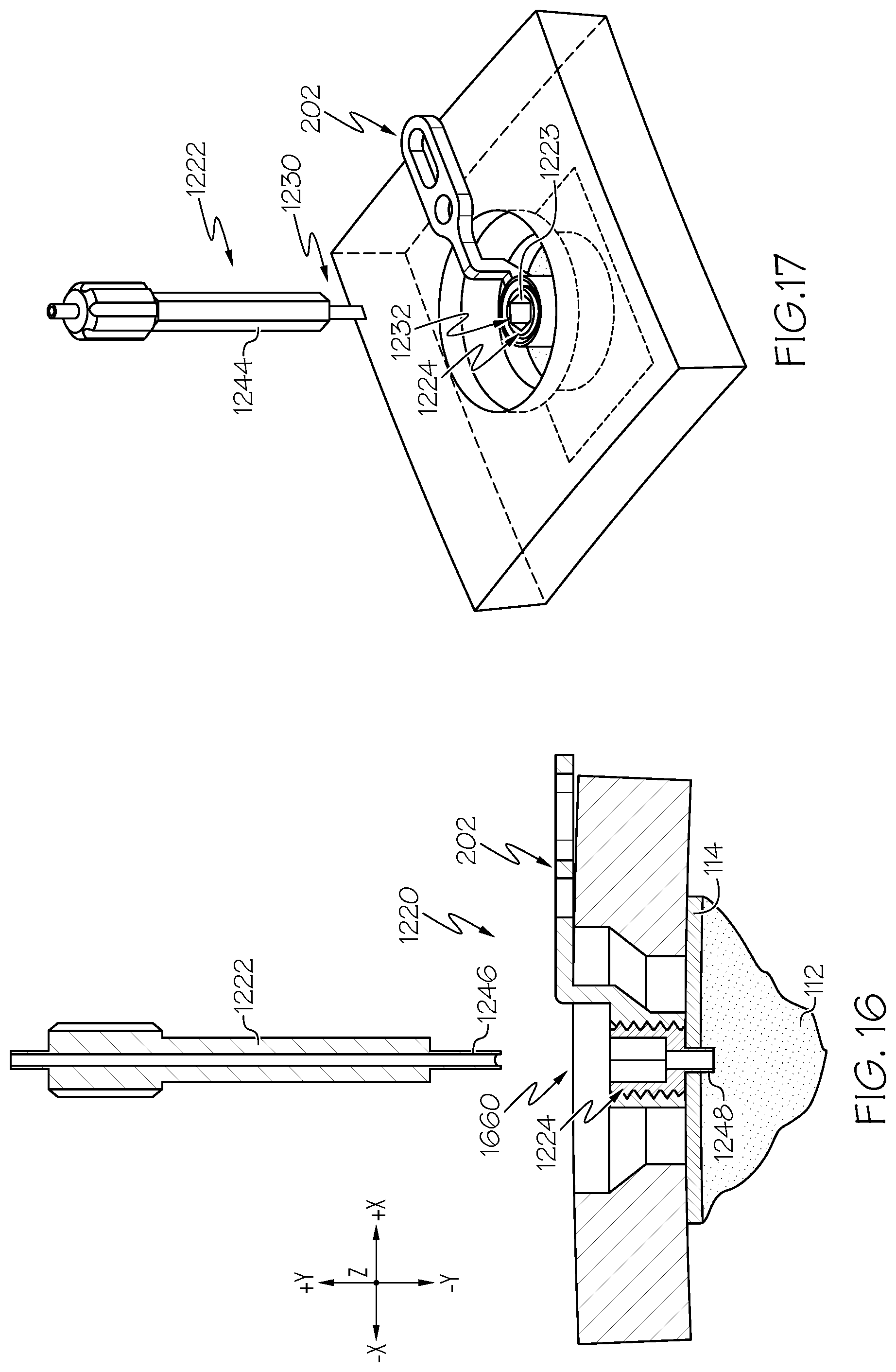 Patent US12508405 Figure 11 – Surgical method, device, system and kit for the treatment of hydrocephalus