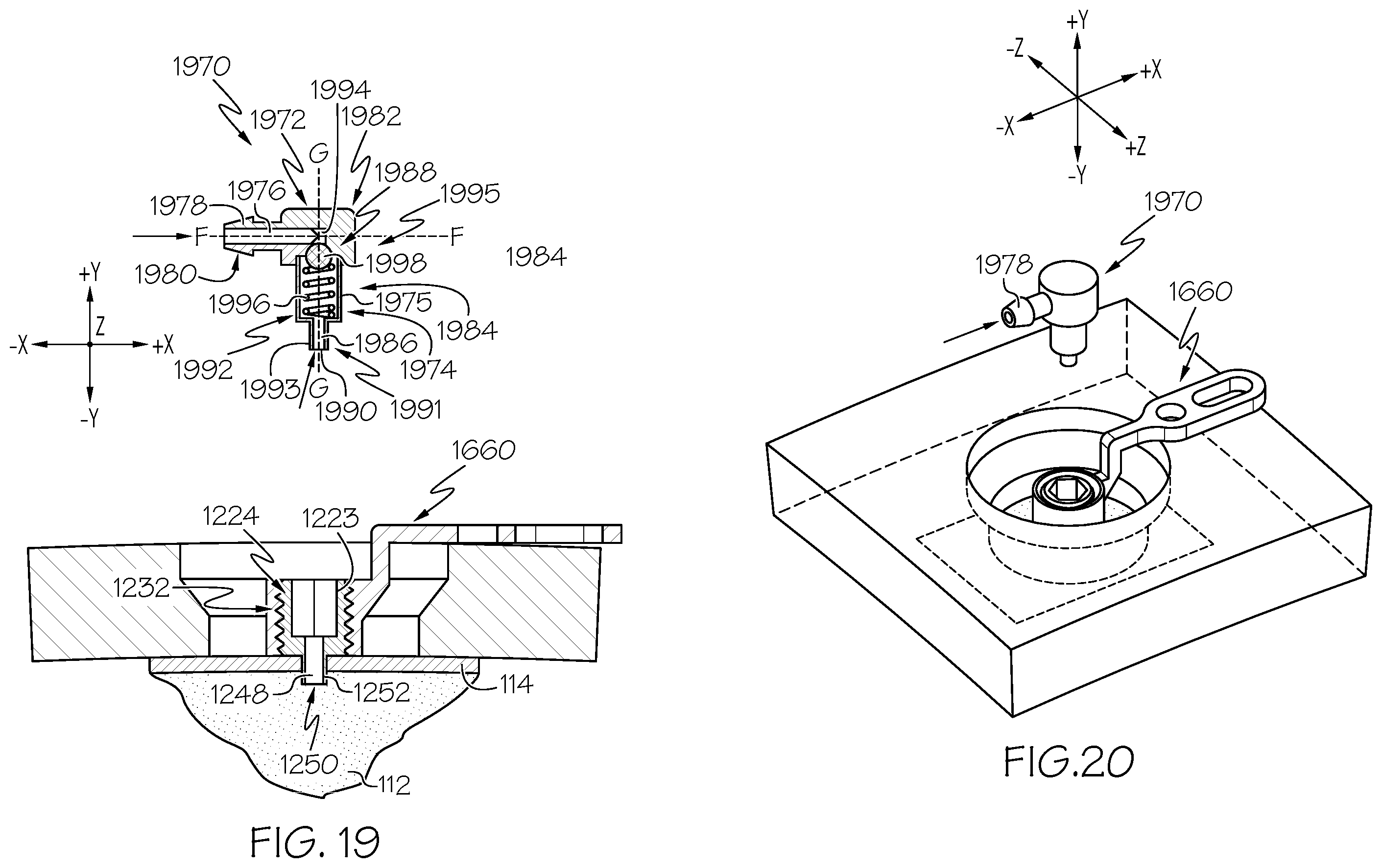 Patent US12508405 Figure 13 – Surgical method, device, system and kit for the treatment of hydrocephalus