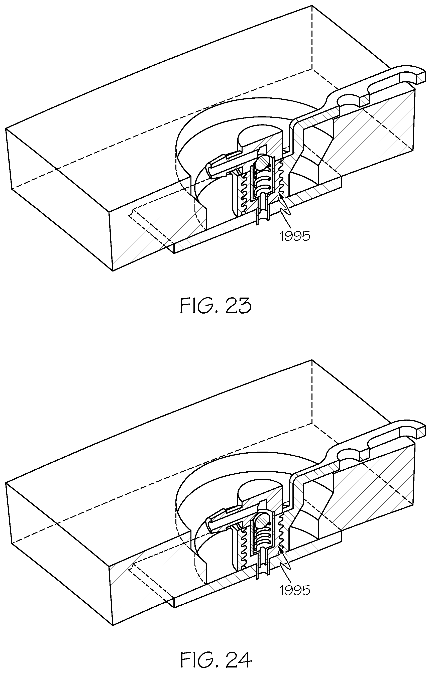 Patent US12508405 Figure 15 – Surgical method, device, system and kit for the treatment of hydrocephalus
