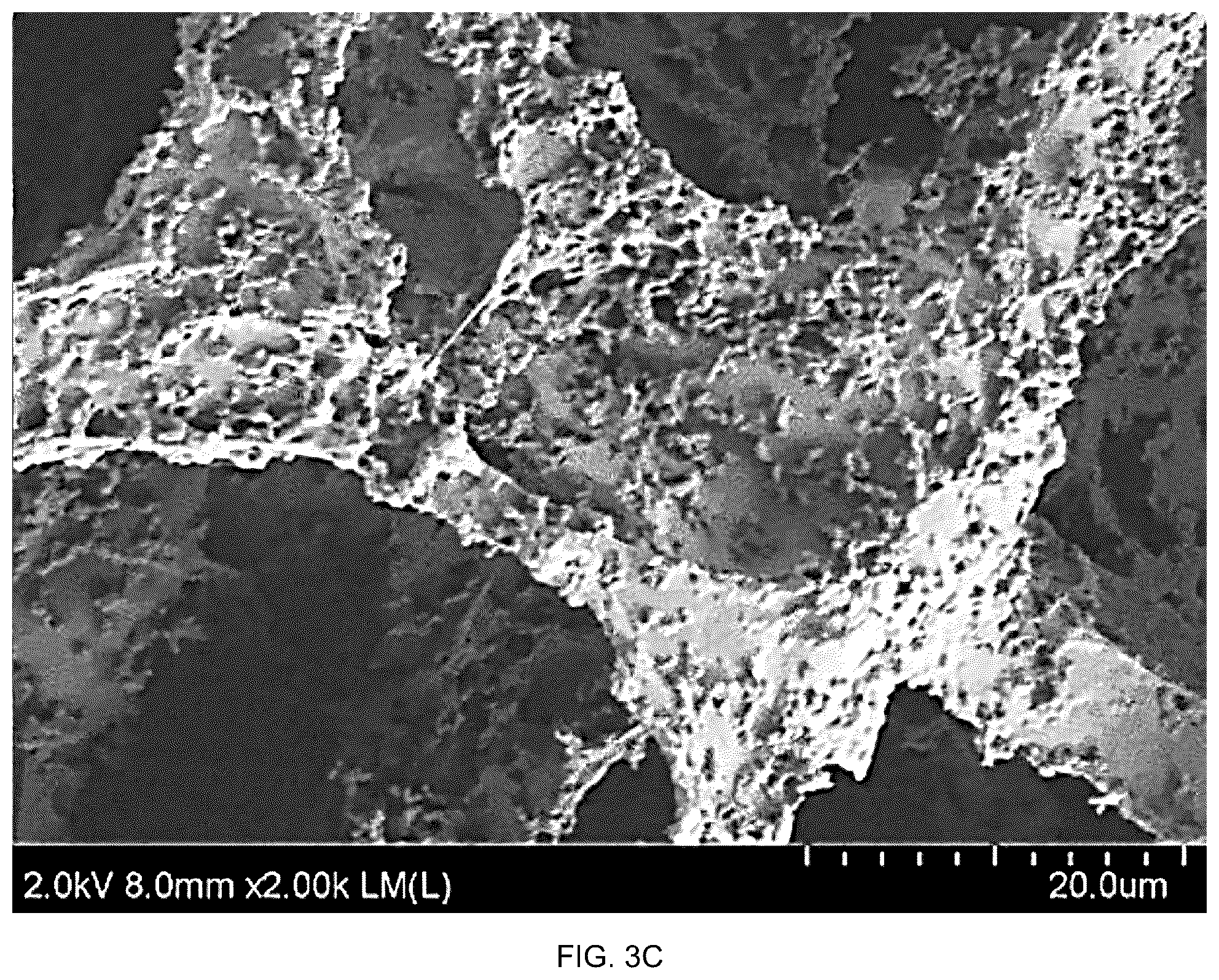 Patent US12508408 Figure 10 – Chitosan porous structure-based magnetically actuated microrobot