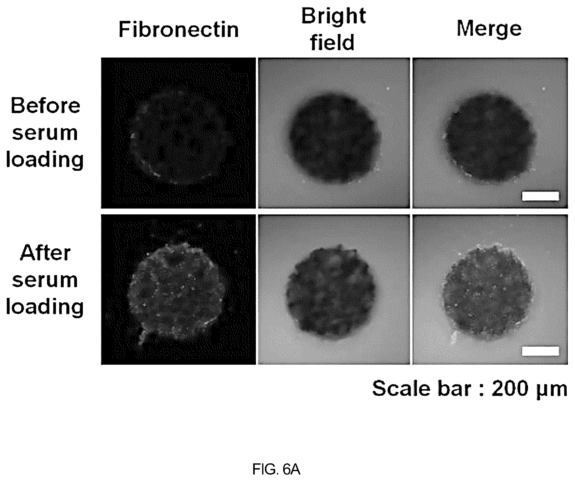 Patent US12508408 Figure 15 – Chitosan porous structure-based magnetically actuated microrobot