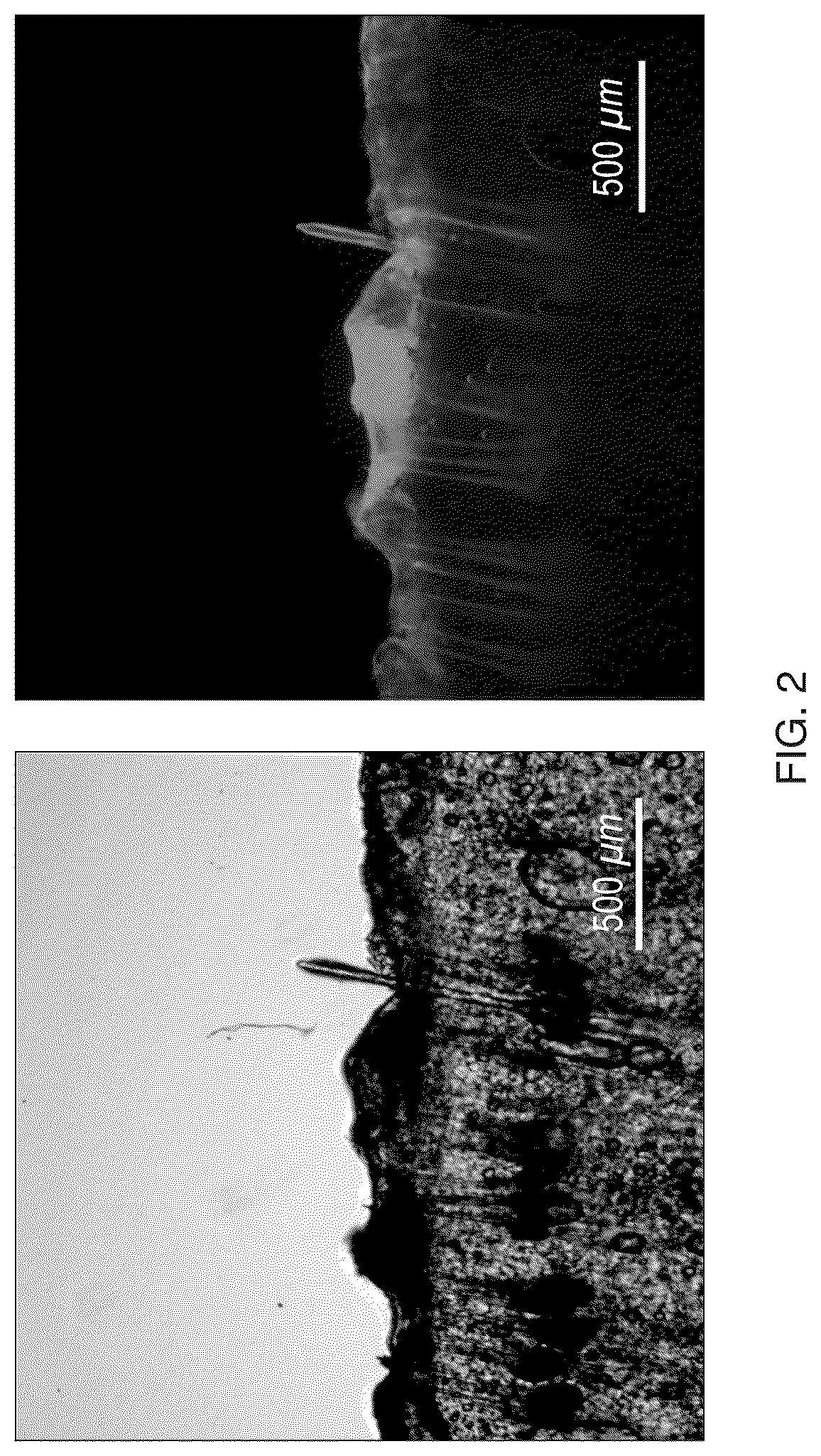 Patent US12508409 Figure 2 – System and method to use suction to enhance permeabilization and transfection of cells