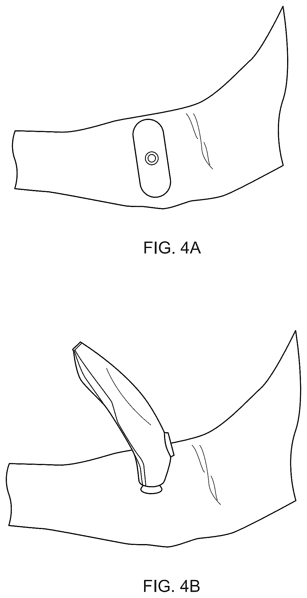 Patent US12508409 Figure 4 – System and method to use suction to enhance permeabilization and transfection of cells