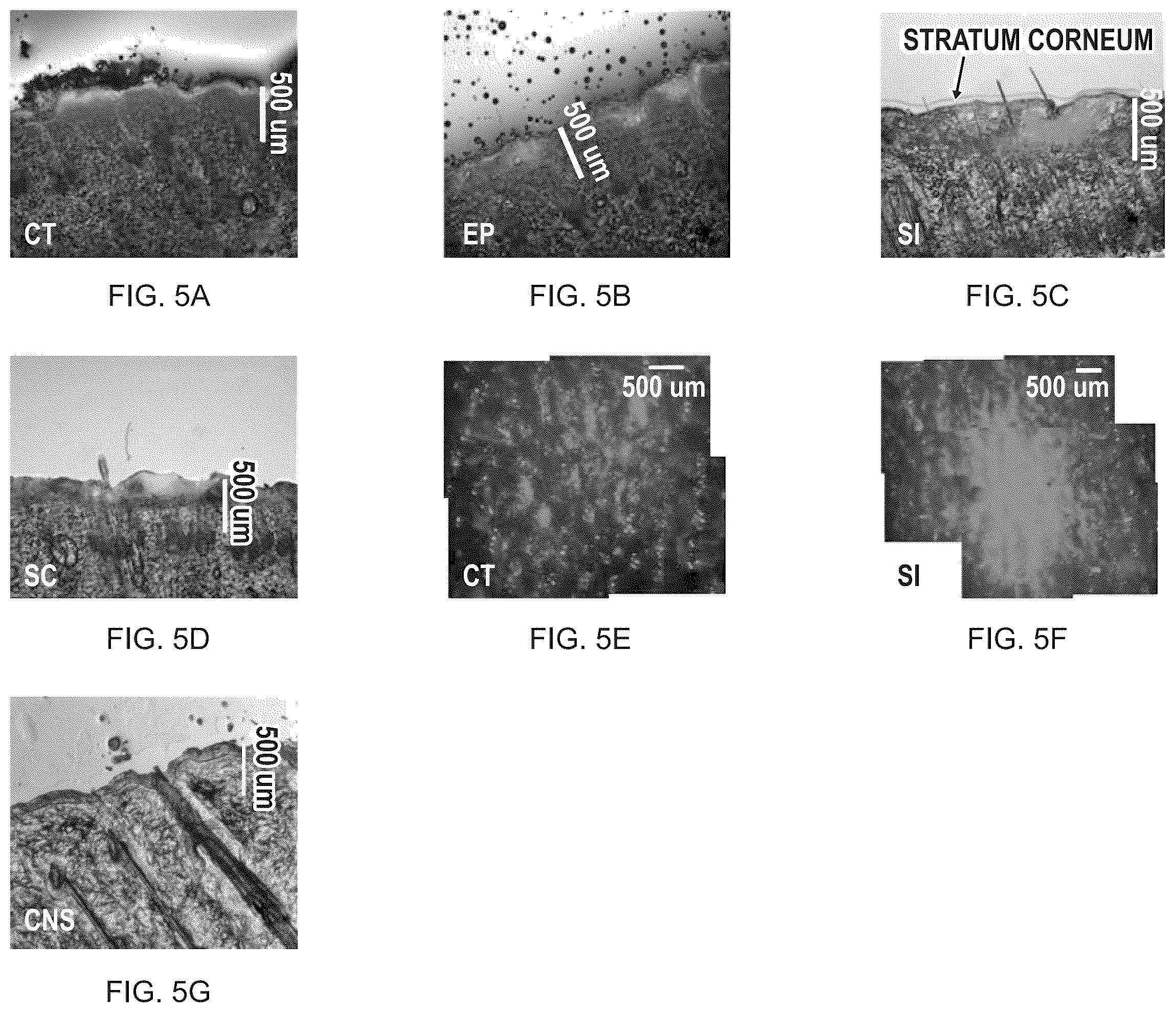Patent US12508409 Figure 5 – System and method to use suction to enhance permeabilization and transfection of cells
