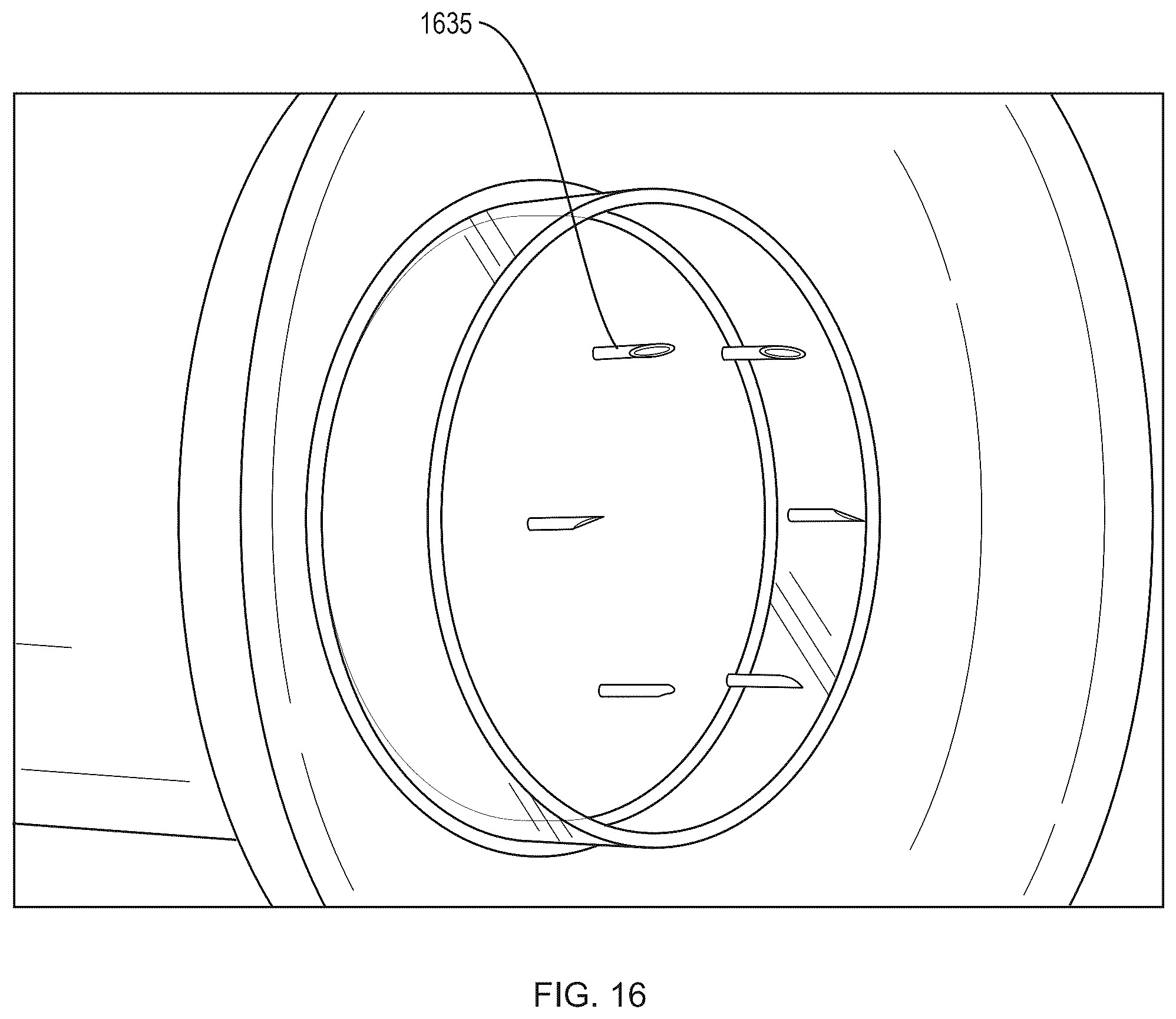 Patent US12508409 Figure 16 – System and method to use suction to enhance permeabilization and transfection of cells