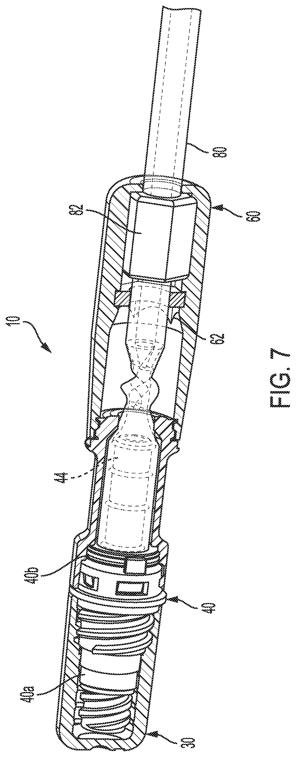 Patent US12508415 Figure 5 – Tube twist tubing occluder
