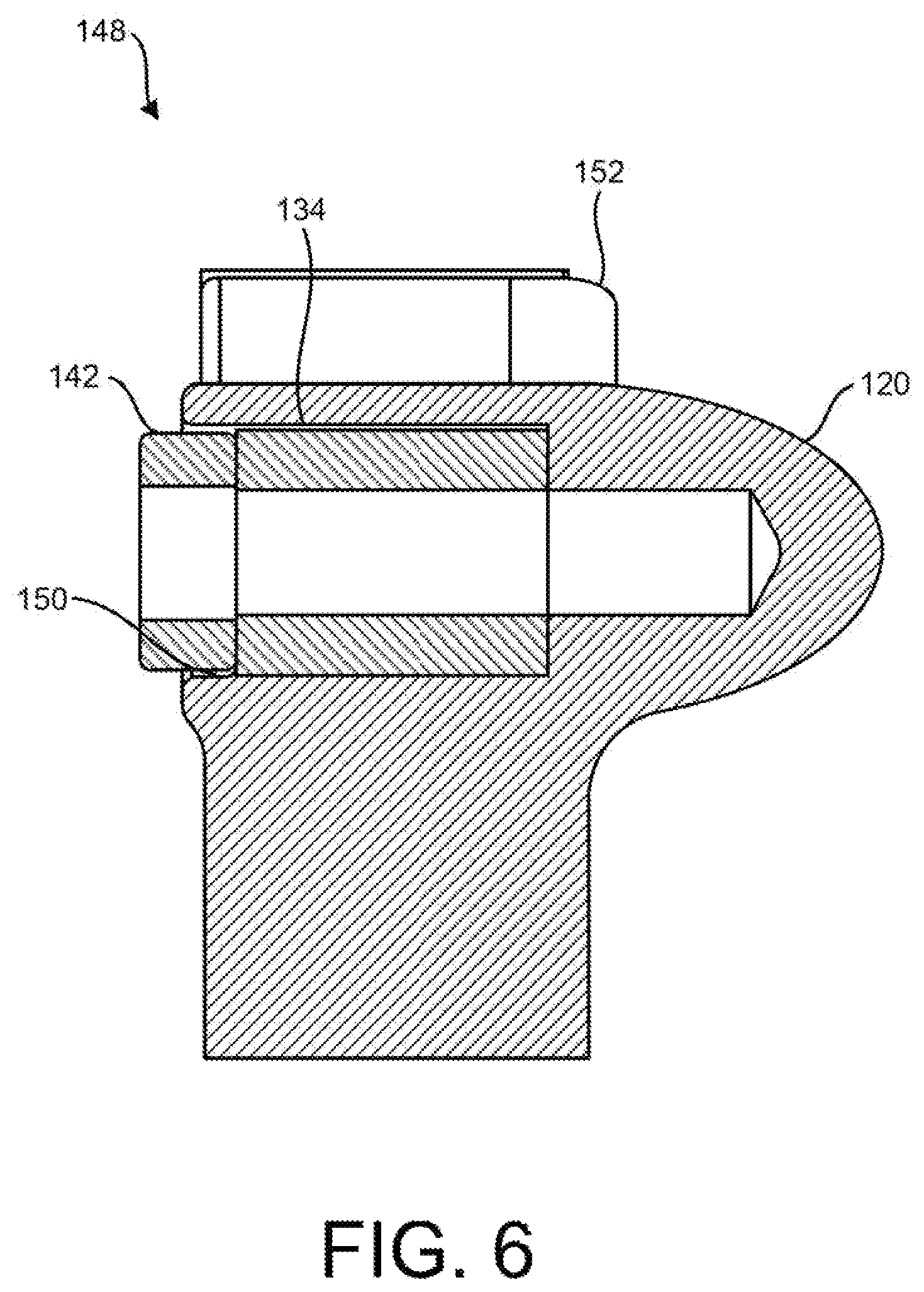 Patent US12508416 Figure 6 – Percutaneous circulatory support system facilitating reduced hemolysis