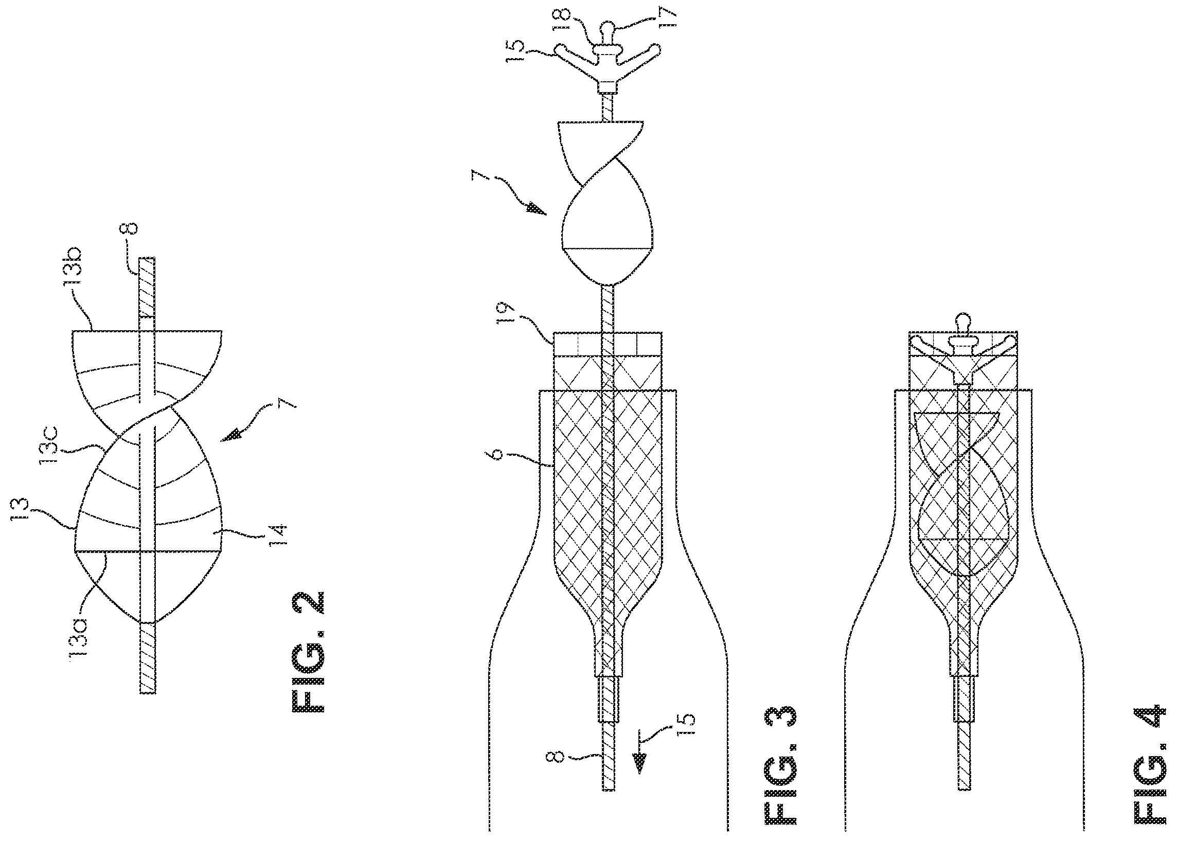 Patent US12508417 Figure 2 – Fluid pump changeable in diameter, in particular for medical application