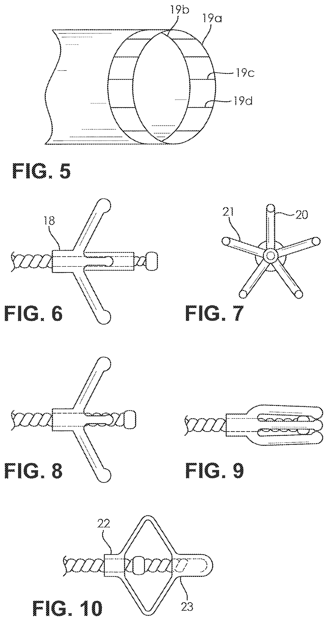 Patent US12508417 Figure 3 – Fluid pump changeable in diameter, in particular for medical application
