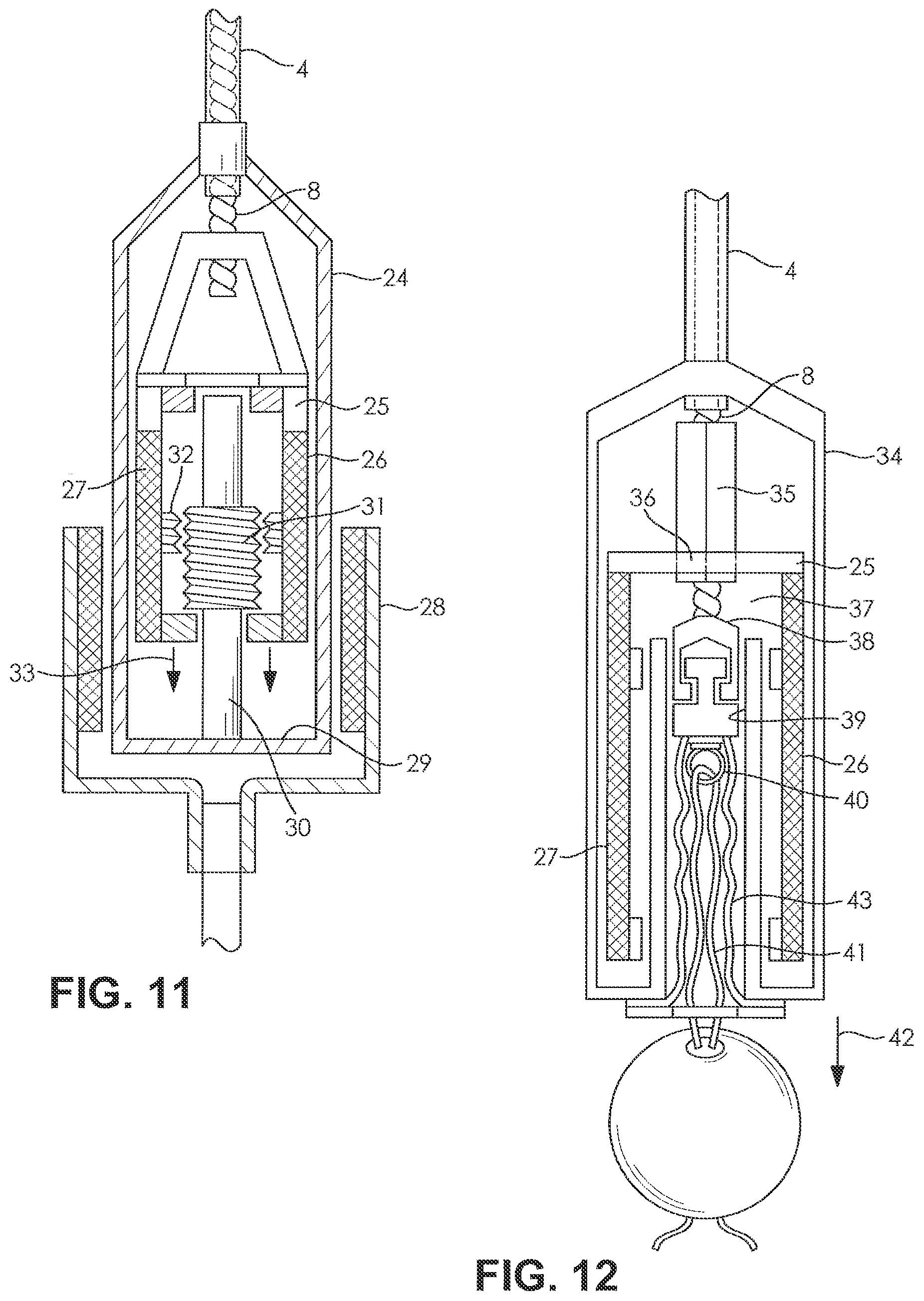 Patent US12508417 Figure 4 – Fluid pump changeable in diameter, in particular for medical application