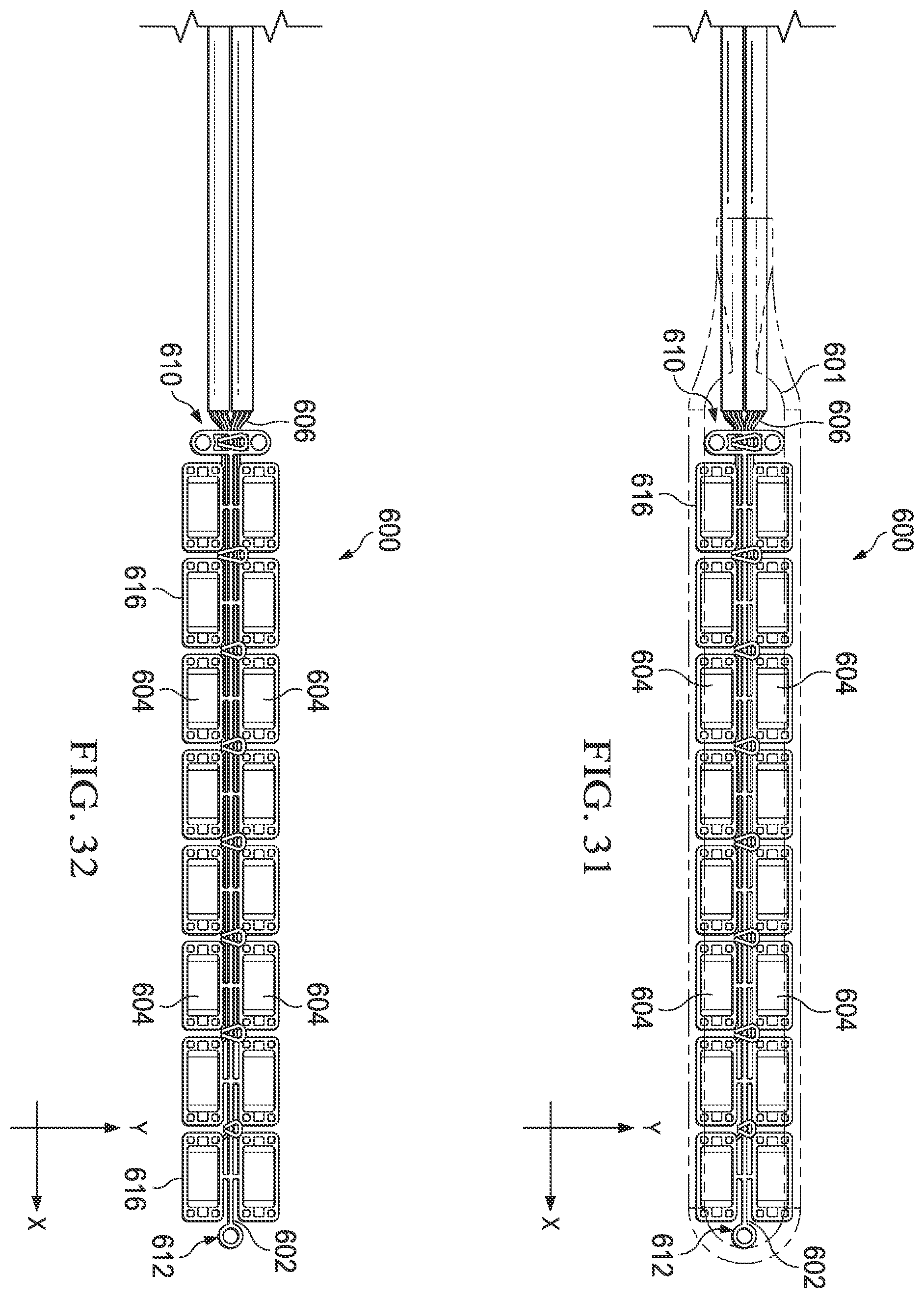Patent US12508420 Figure 20 – Electrode assembly
