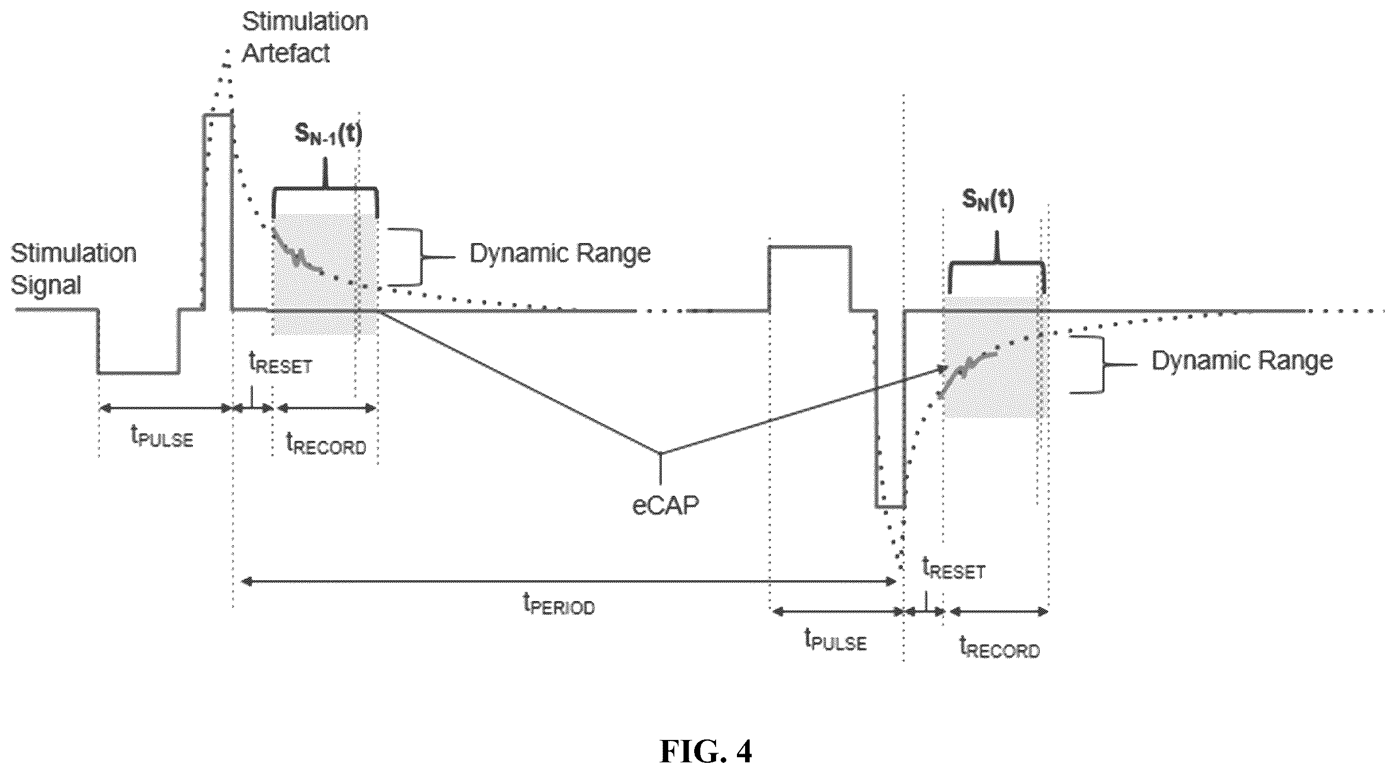 Patent US12508421 Figure 4 – System and method for monitoring response to neuromodulation
