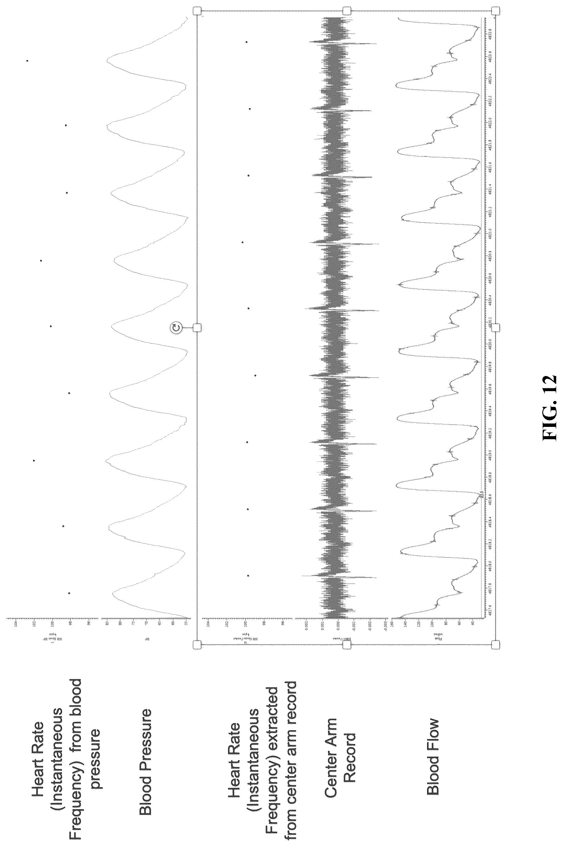 Patent US12508421 Figure 12 – System and method for monitoring response to neuromodulation