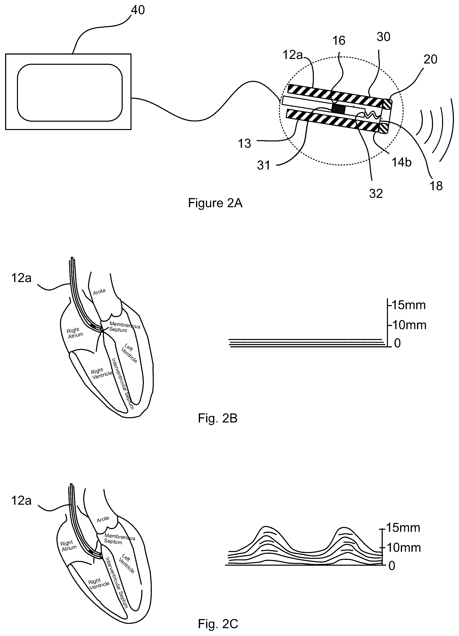 Patent US12508422 Figure 2 – Ultrasound guidance assembly and system