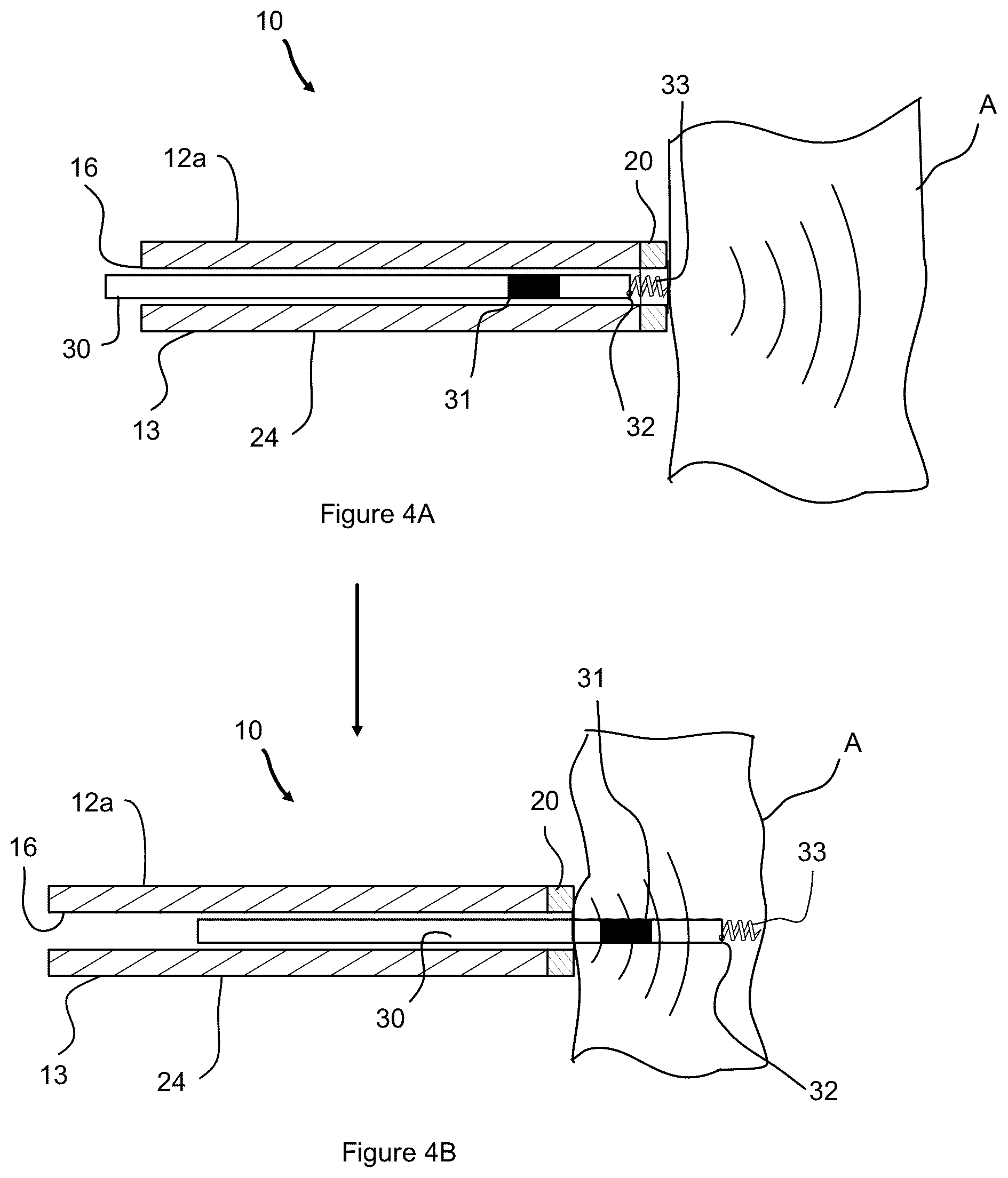 Patent US12508422 Figure 4 – Ultrasound guidance assembly and system