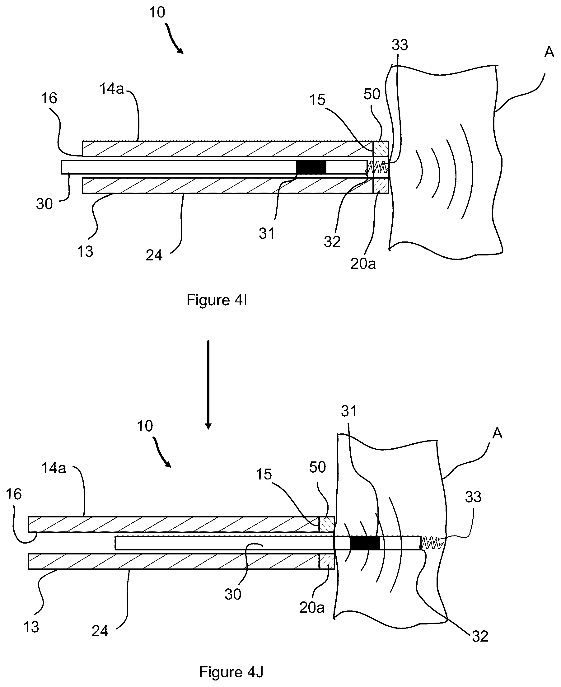 Patent US12508422 Figure 8 – Ultrasound guidance assembly and system