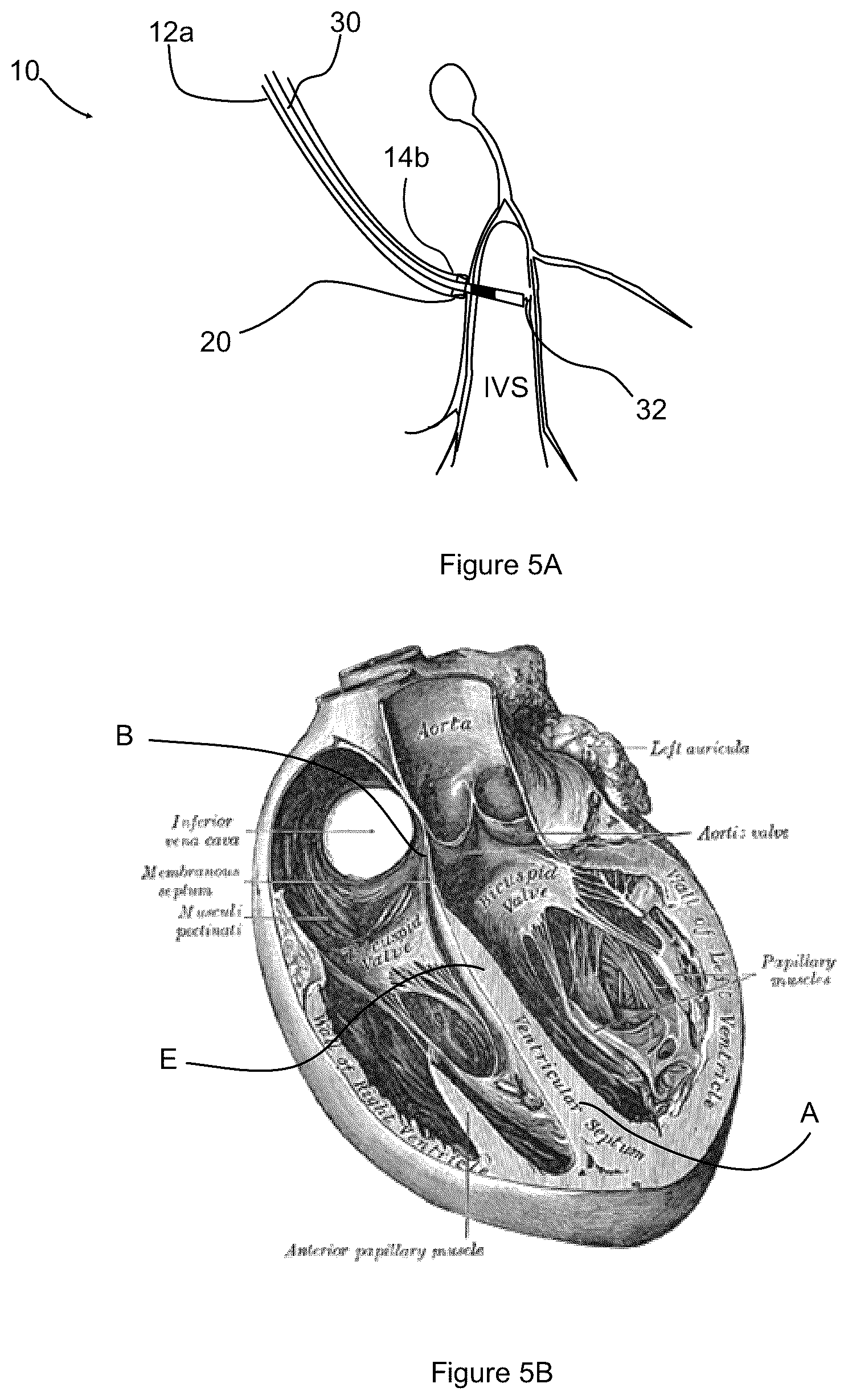 Patent US12508422 Figure 9 – Ultrasound guidance assembly and system
