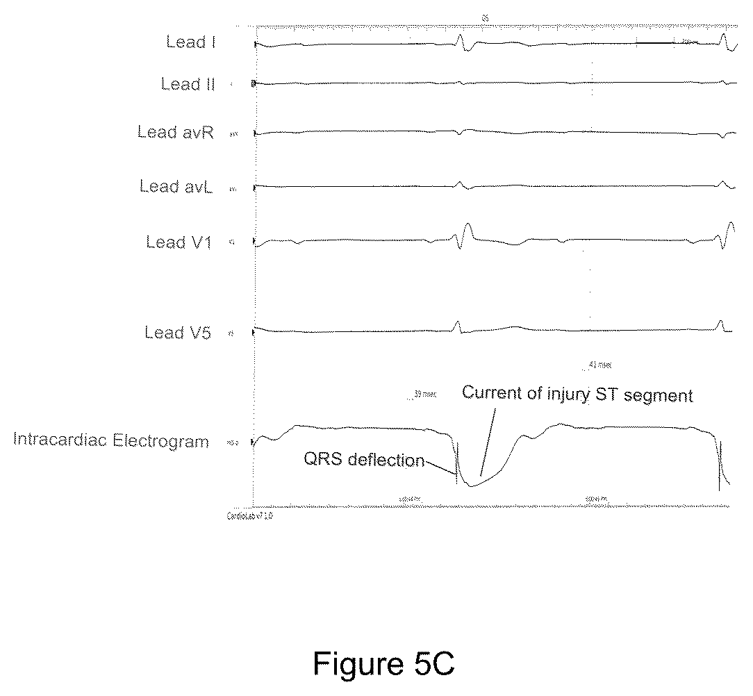 Patent US12508422 Figure 10 – Ultrasound guidance assembly and system