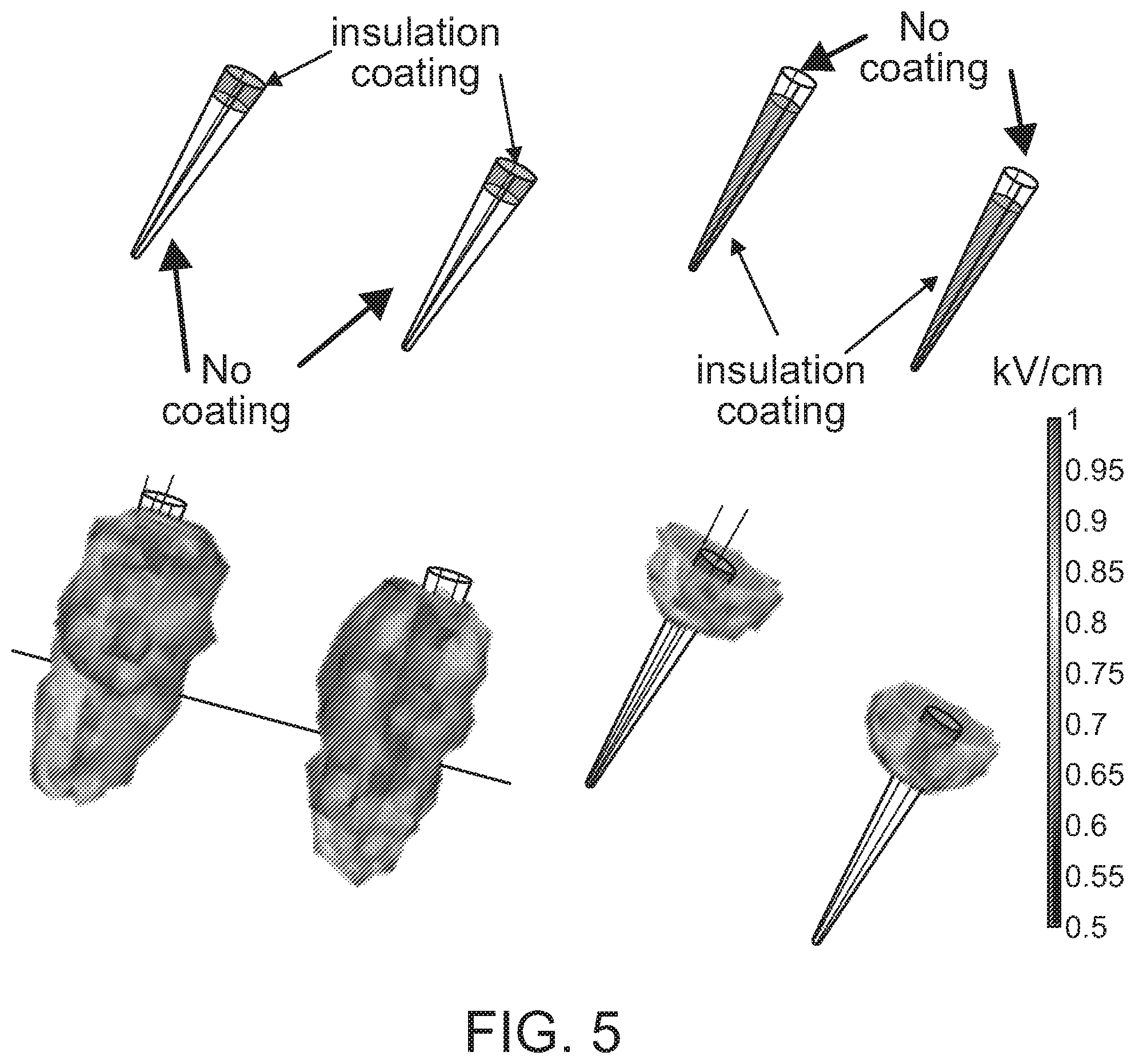 Patent US12508423 Figure 5 – Device for tissue electrotransfer using a microelectrode