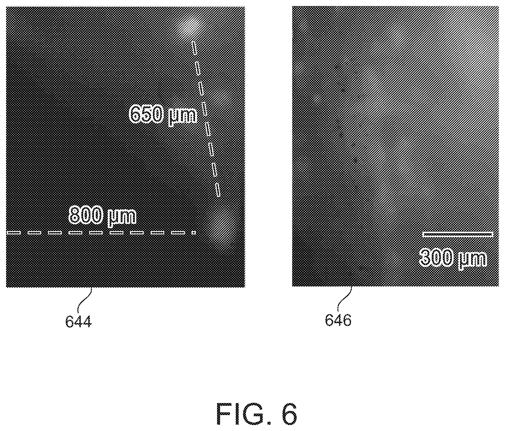 Patent US12508423 Figure 6 – Device for tissue electrotransfer using a microelectrode