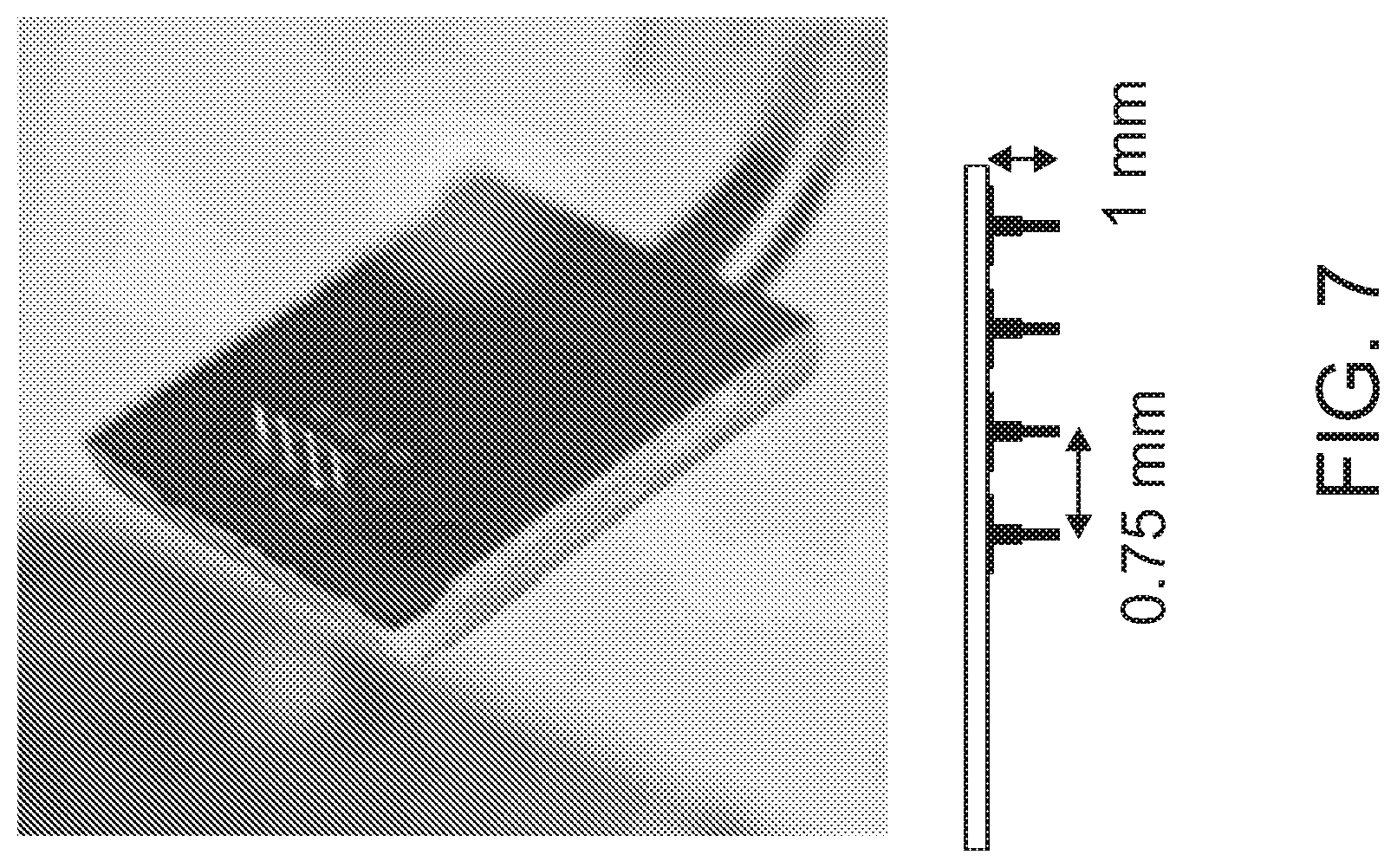 Patent US12508423 Figure 7 – Device for tissue electrotransfer using a microelectrode