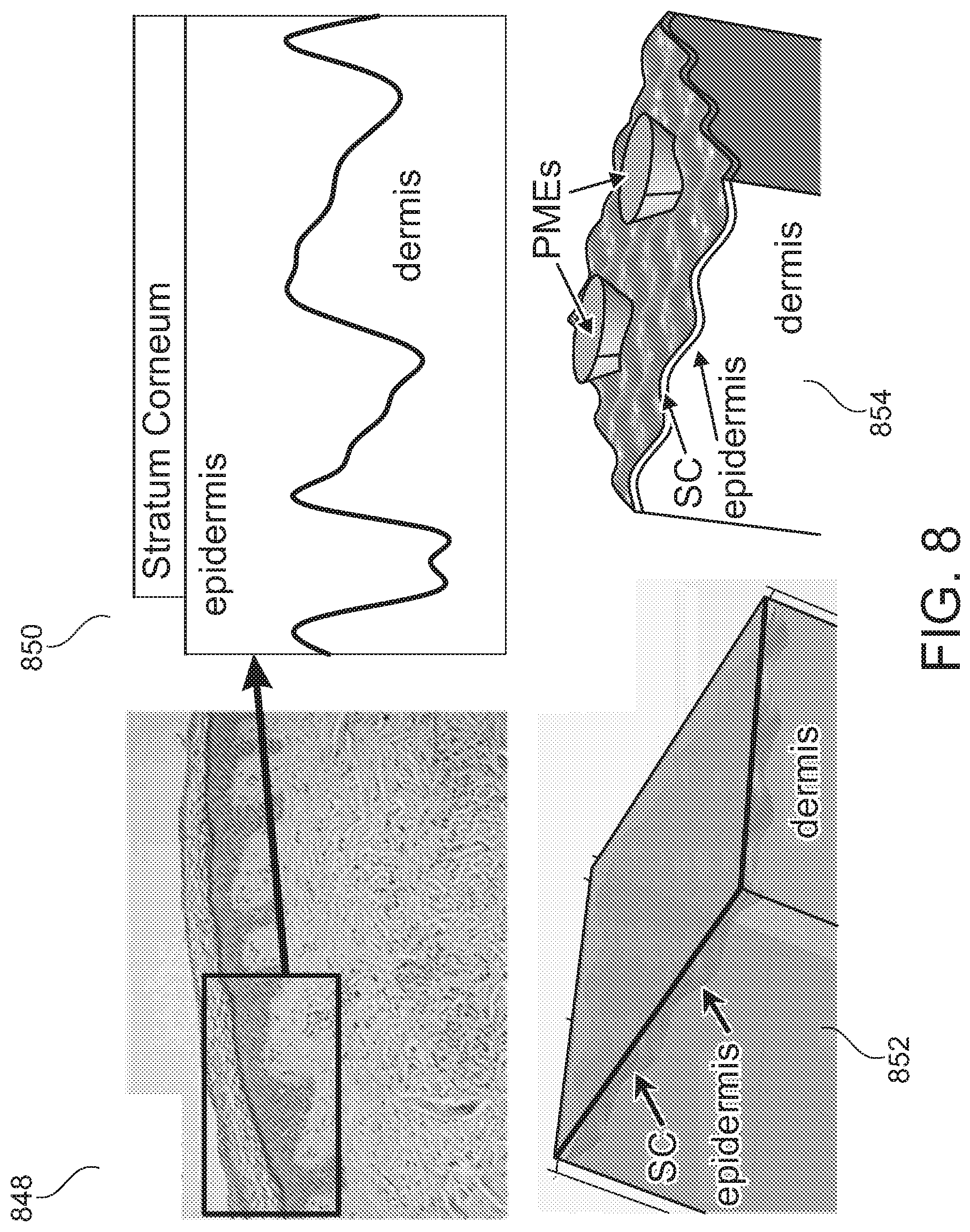 Patent US12508423 Figure 8 – Device for tissue electrotransfer using a microelectrode