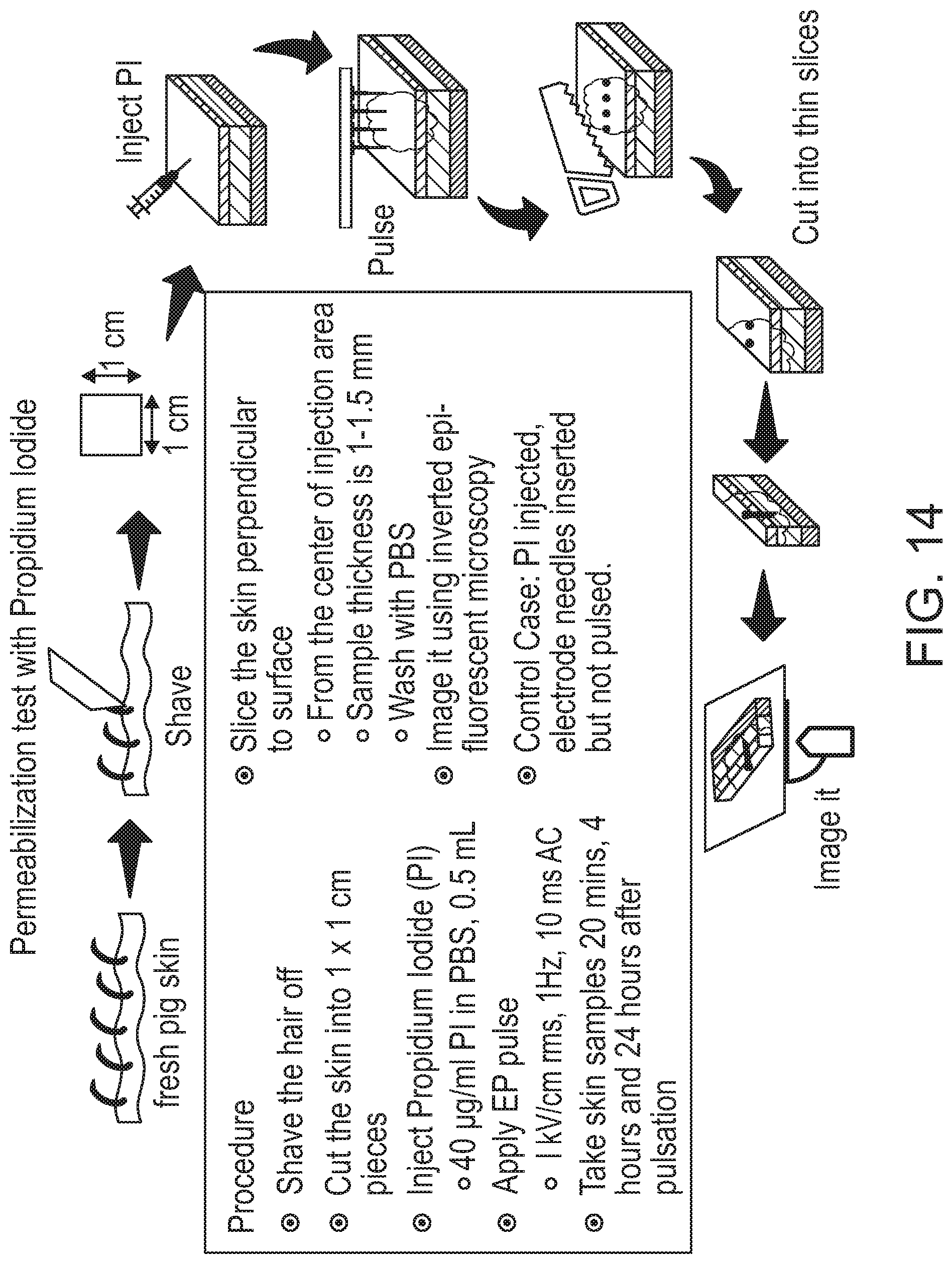 Patent US12508423 Figure 14 – Device for tissue electrotransfer using a microelectrode