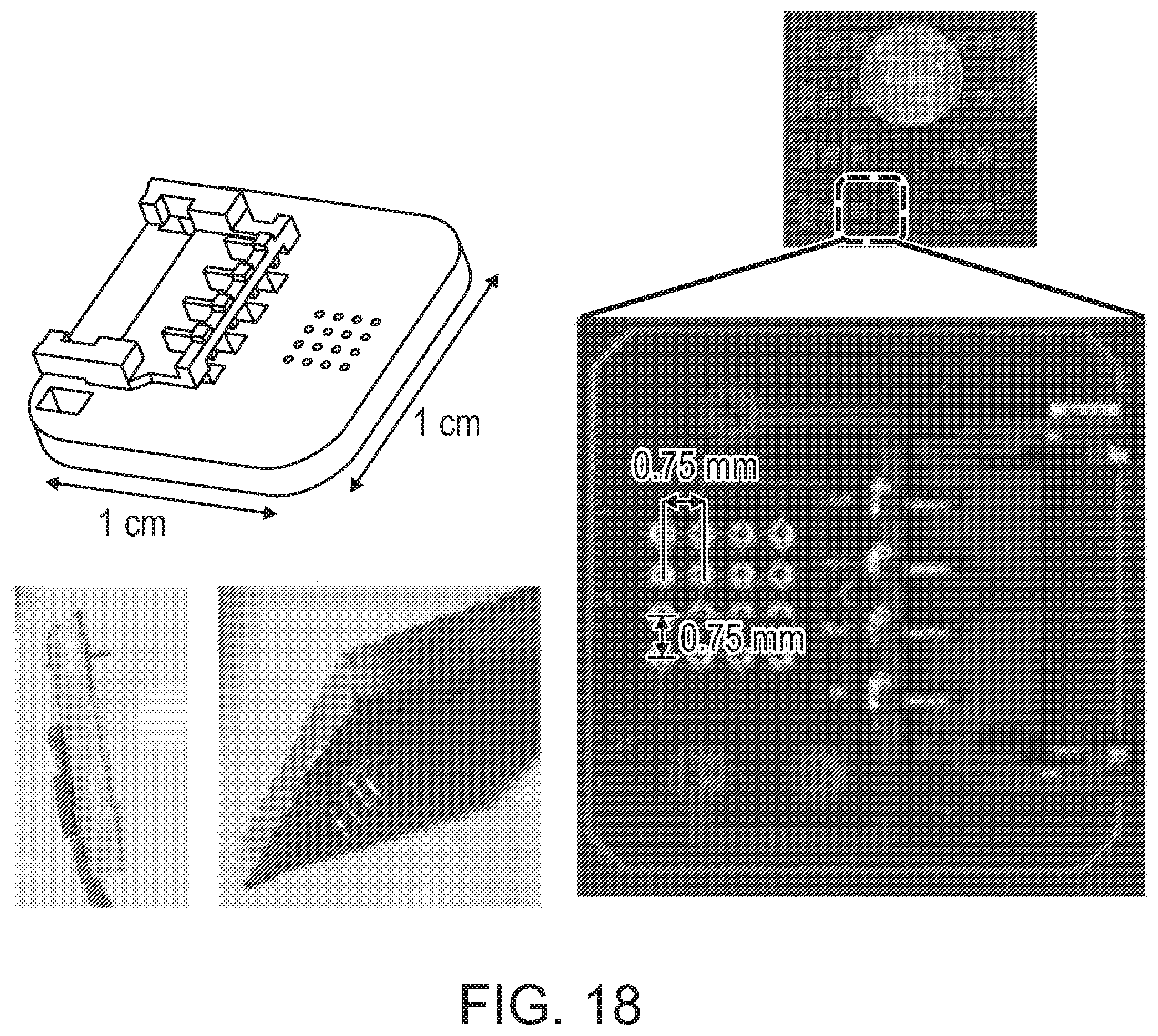 Patent US12508423 Figure 18 – Device for tissue electrotransfer using a microelectrode