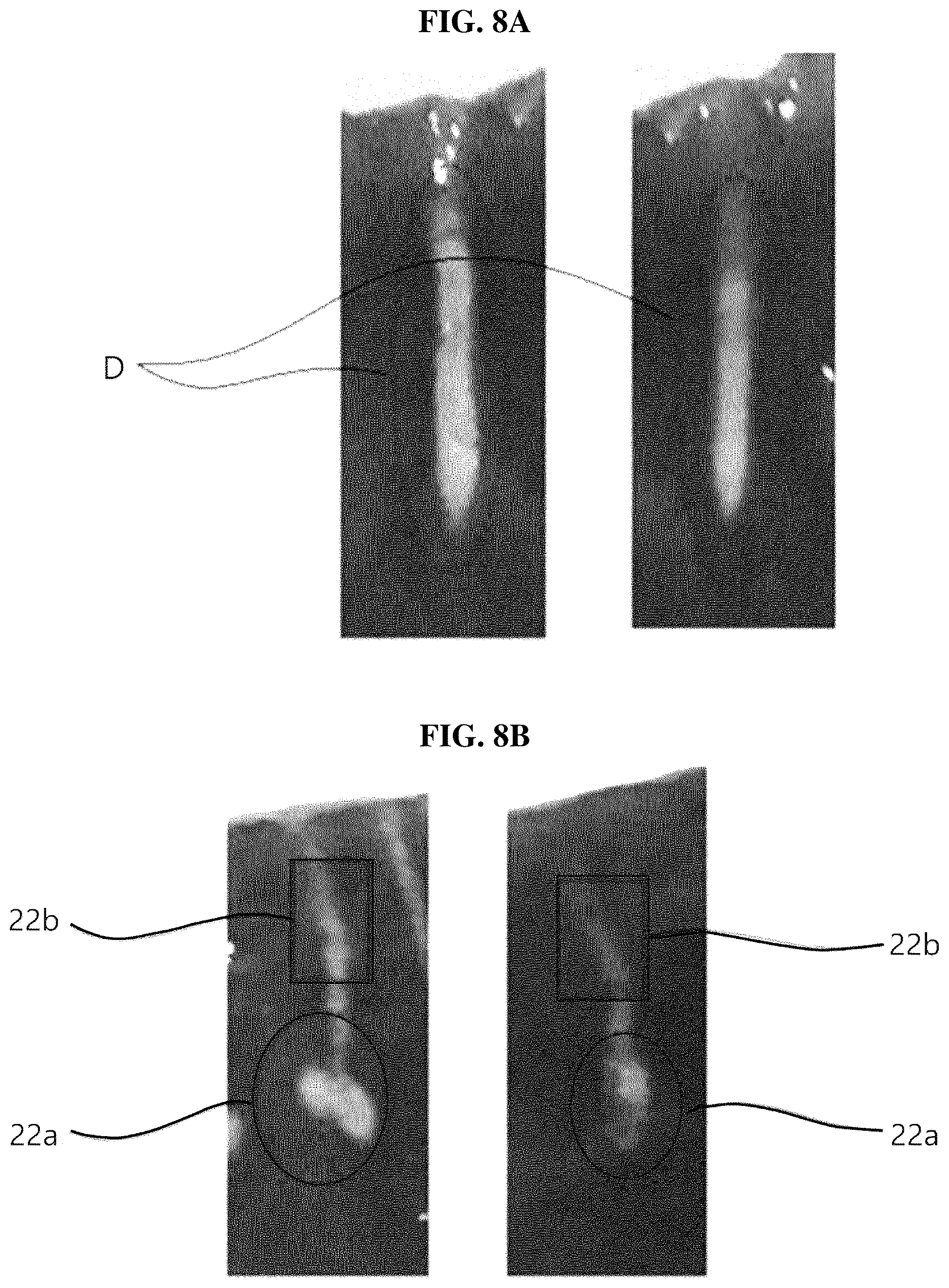 Patent US12508424 Figure 7 – Needle tip for application of current, hand piece, and skin treatment apparatus