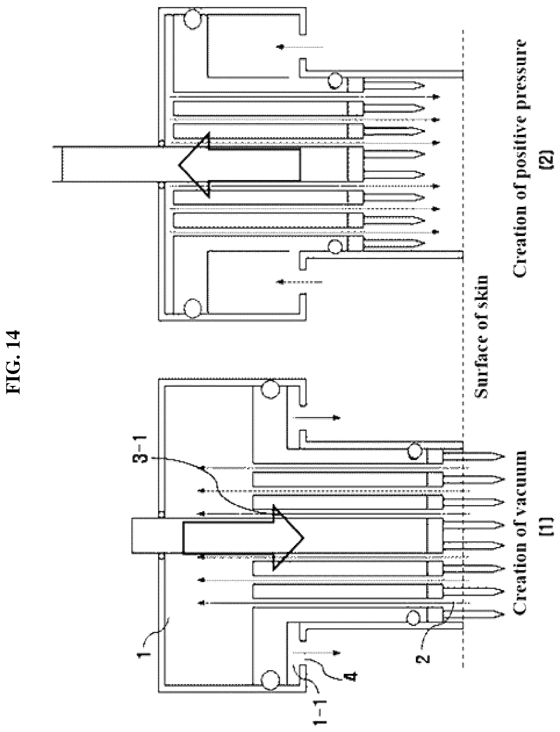 Patent US12508424 Figure 16 – Needle tip for application of current, hand piece, and skin treatment apparatus