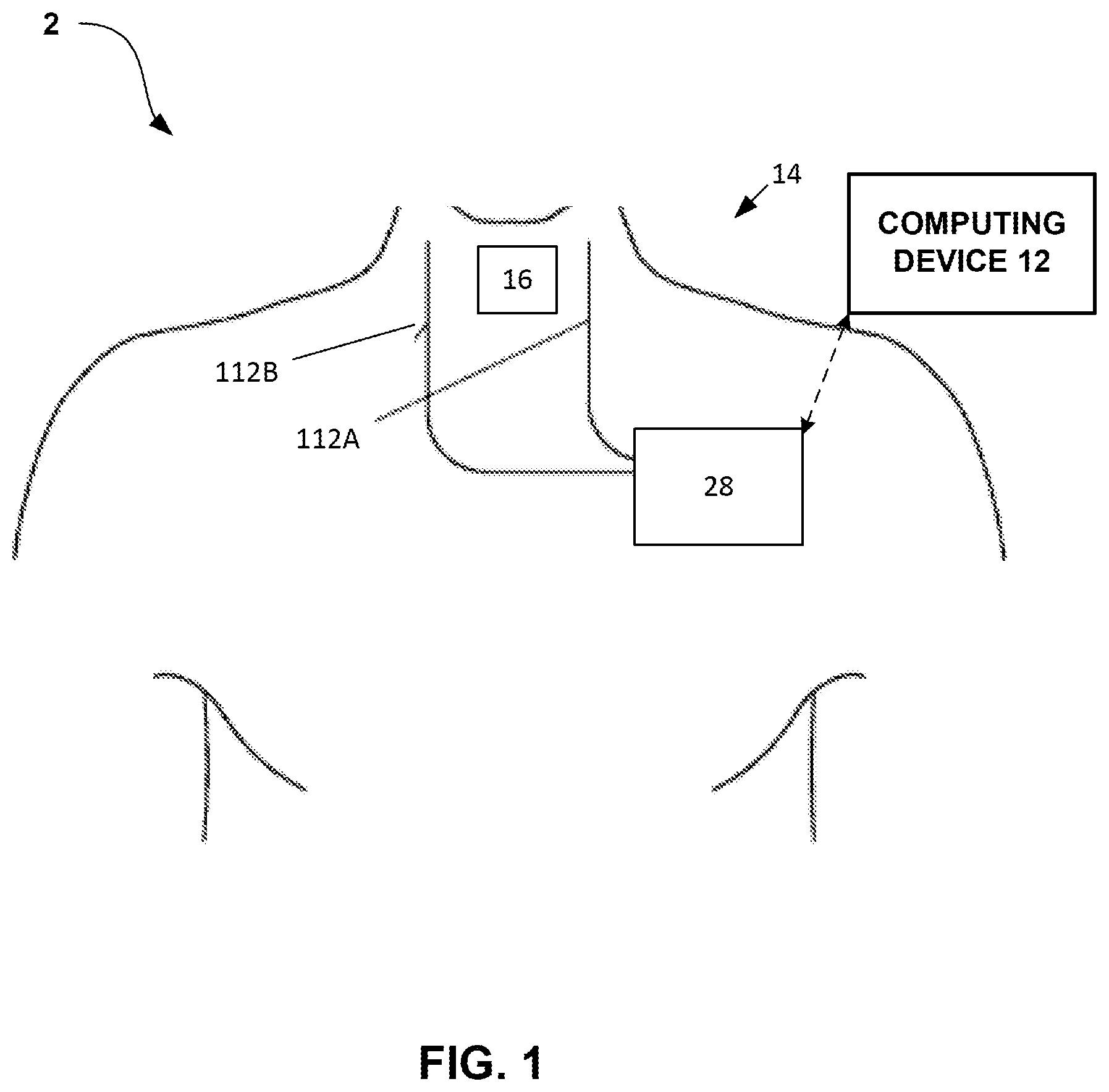 Patent US12508425 — Bilateral vagus nerve stimulation — Figure 1
