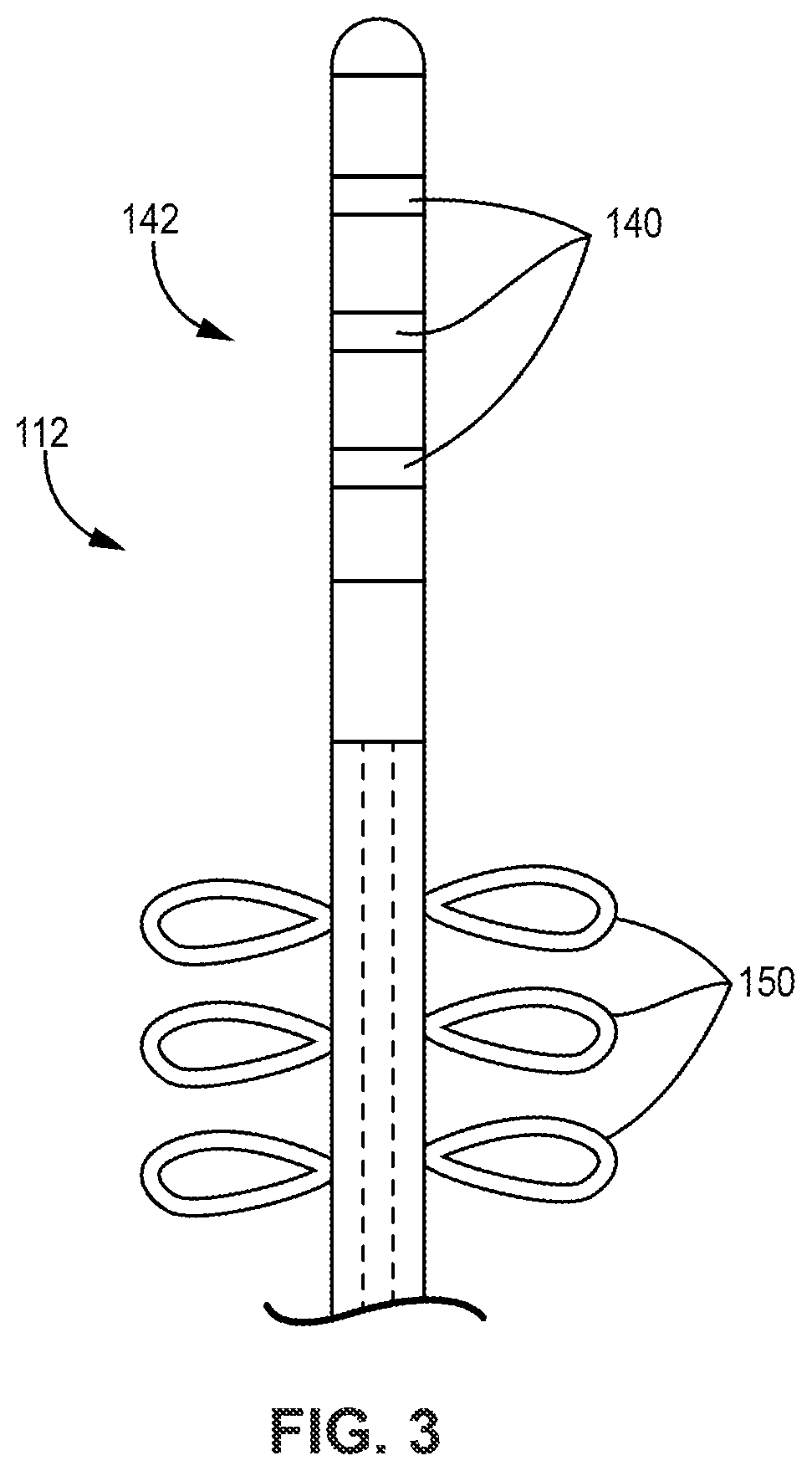 Patent US12508425 Figure 4 – Bilateral vagus nerve stimulation