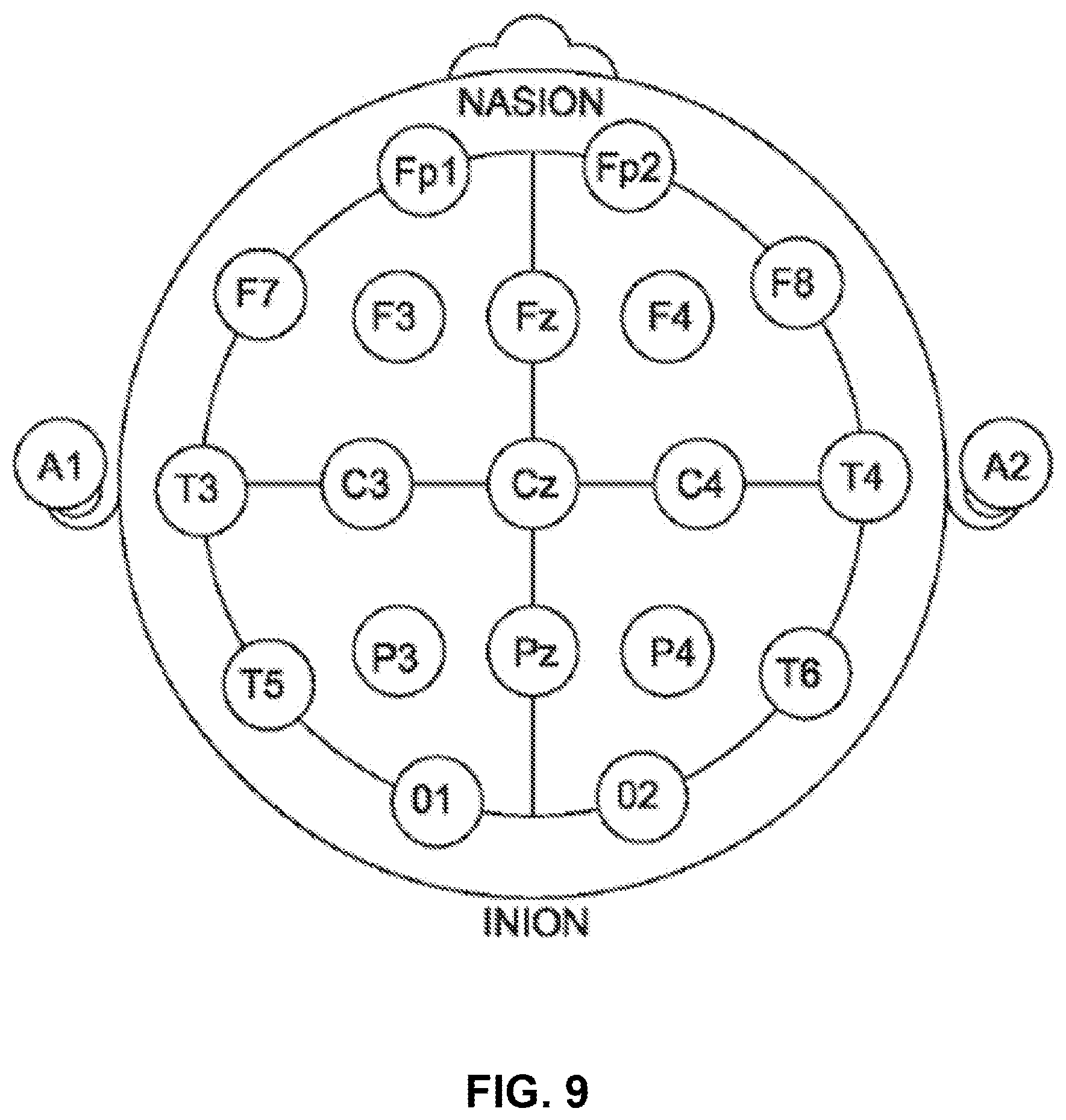 Patent US12508425 Figure 12 – Bilateral vagus nerve stimulation