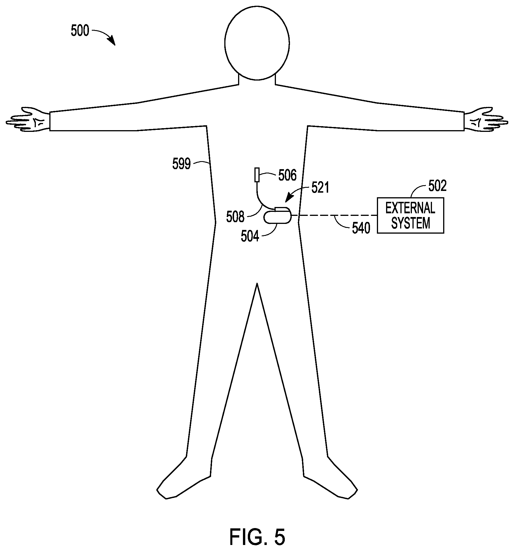 Patent US12508426 Figure 3 – Method and apparatus for optimizing neural sensing