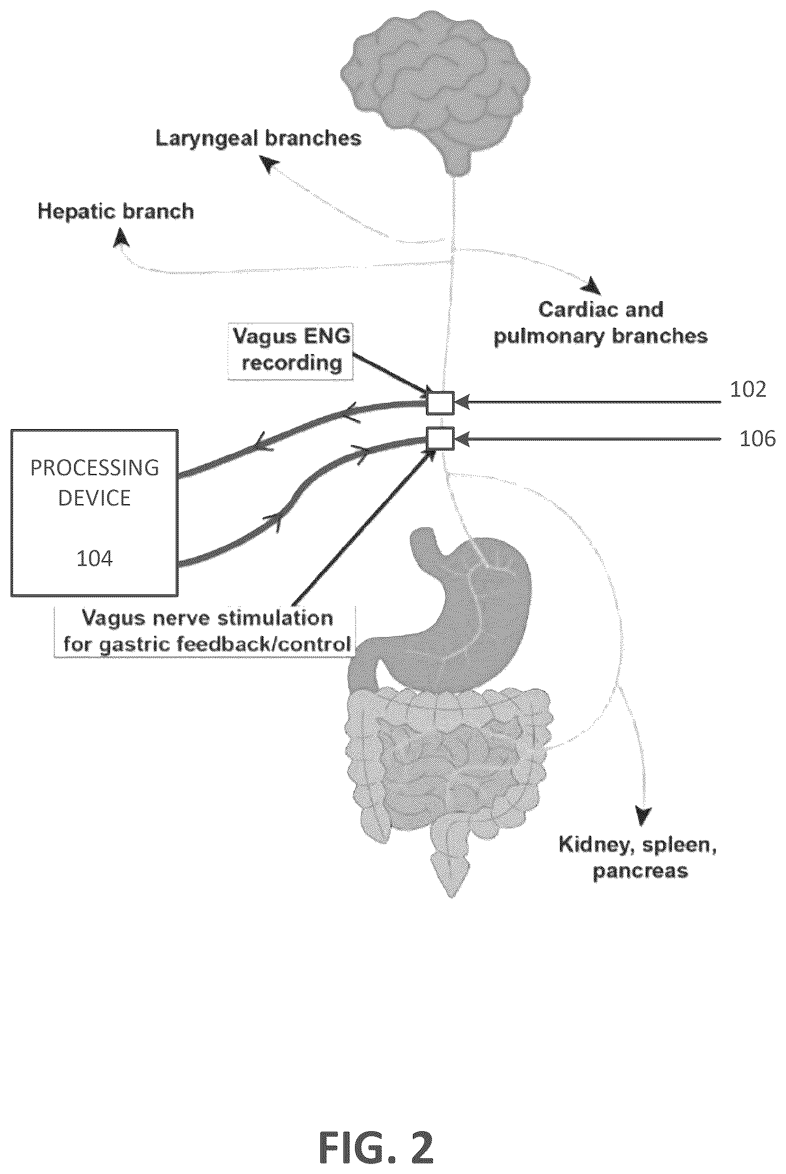 Patent US12508427 Figure 2 – Closed-loop vagus nerve stimulation for the treatment of obesity
