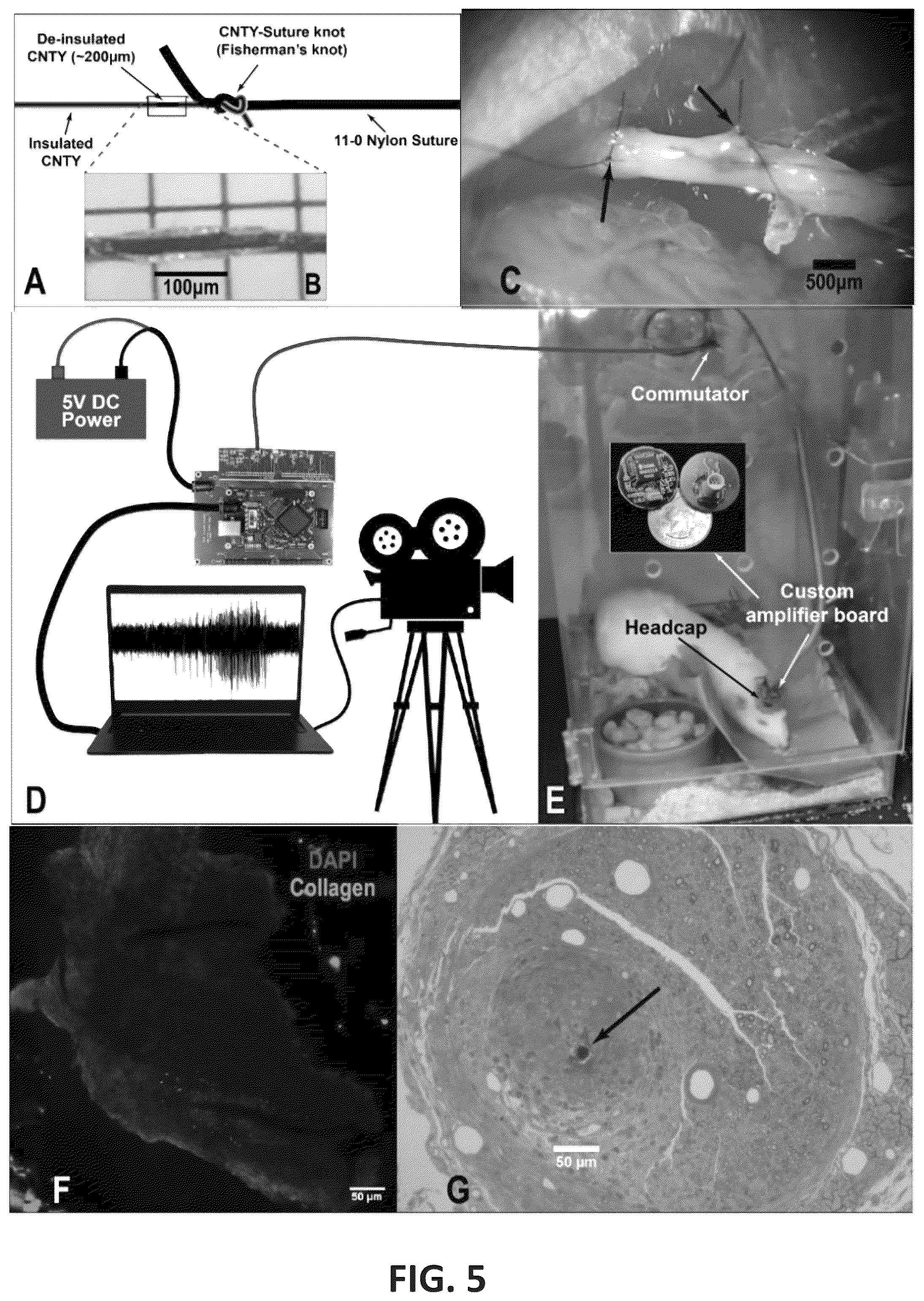 Patent US12508427 Figure 5 – Closed-loop vagus nerve stimulation for the treatment of obesity